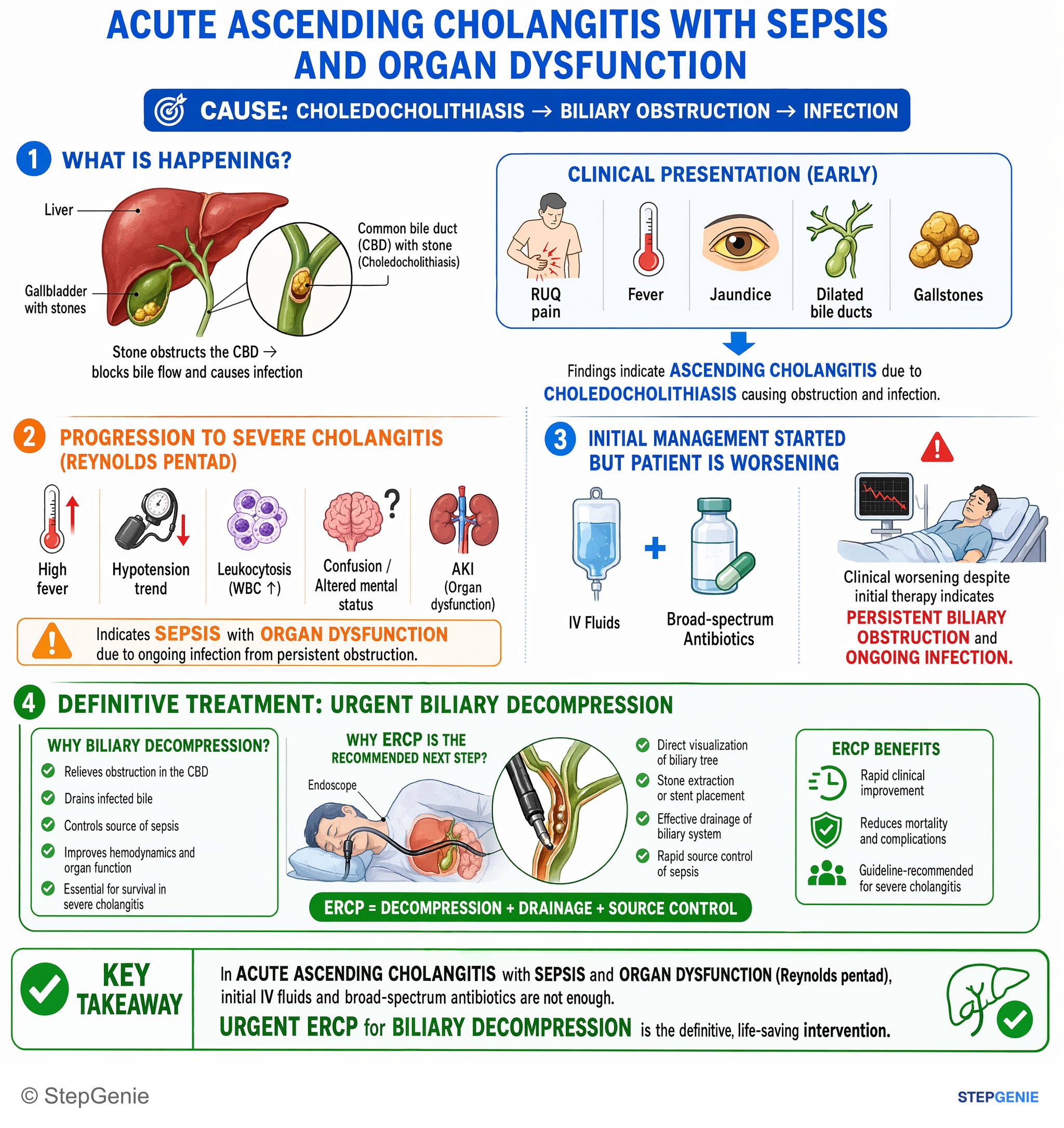 Biliary tract disorders — StepGenie USMLE Step 2 explanation infographic