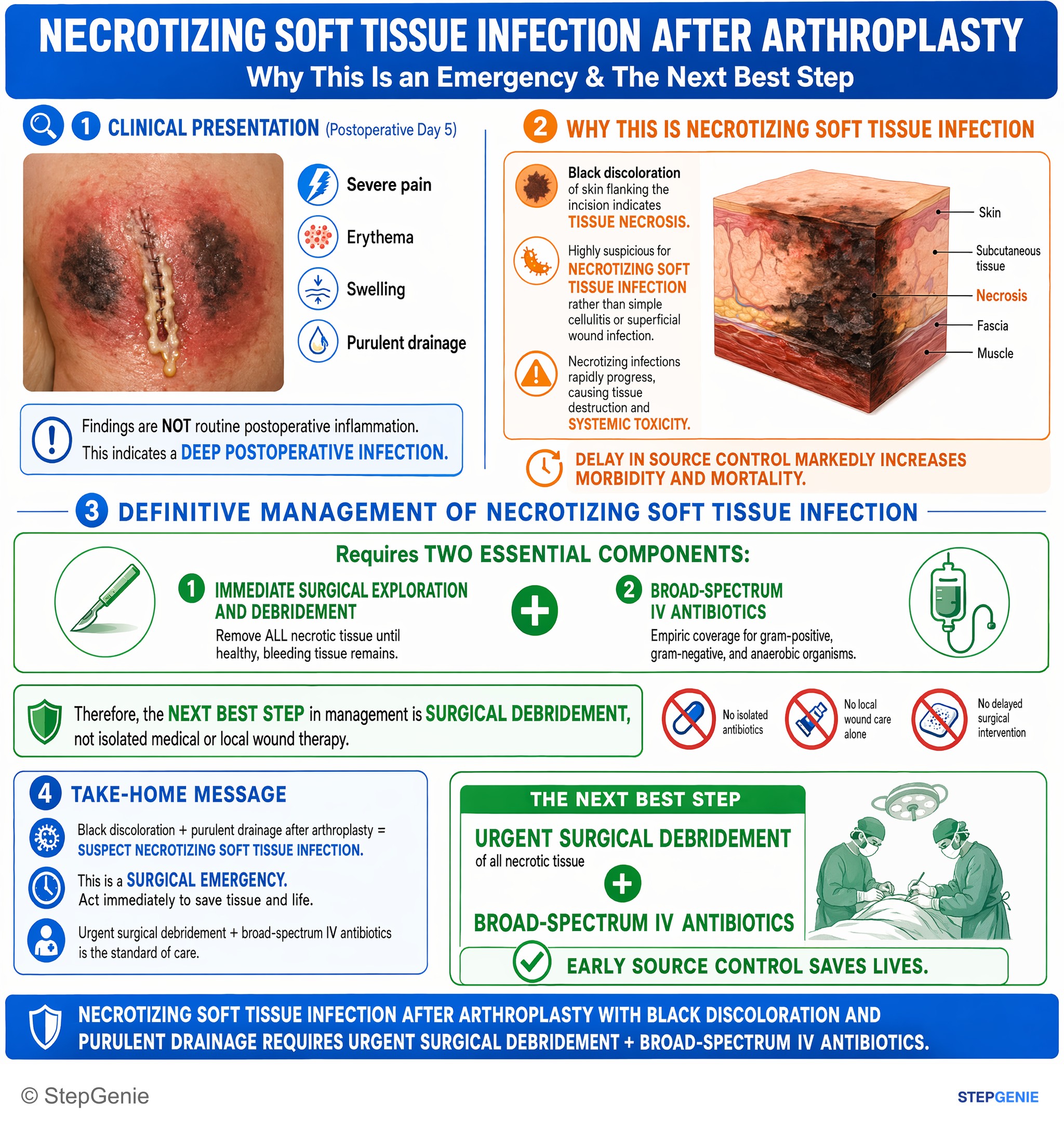 Bacterial infections — StepGenie USMLE Step 2 explanation infographic