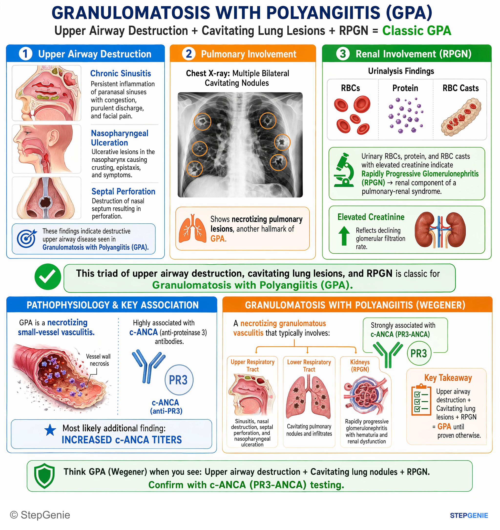 Nephrotic & nephritic syndromes — StepGenie USMLE Step 1 explanation infographic