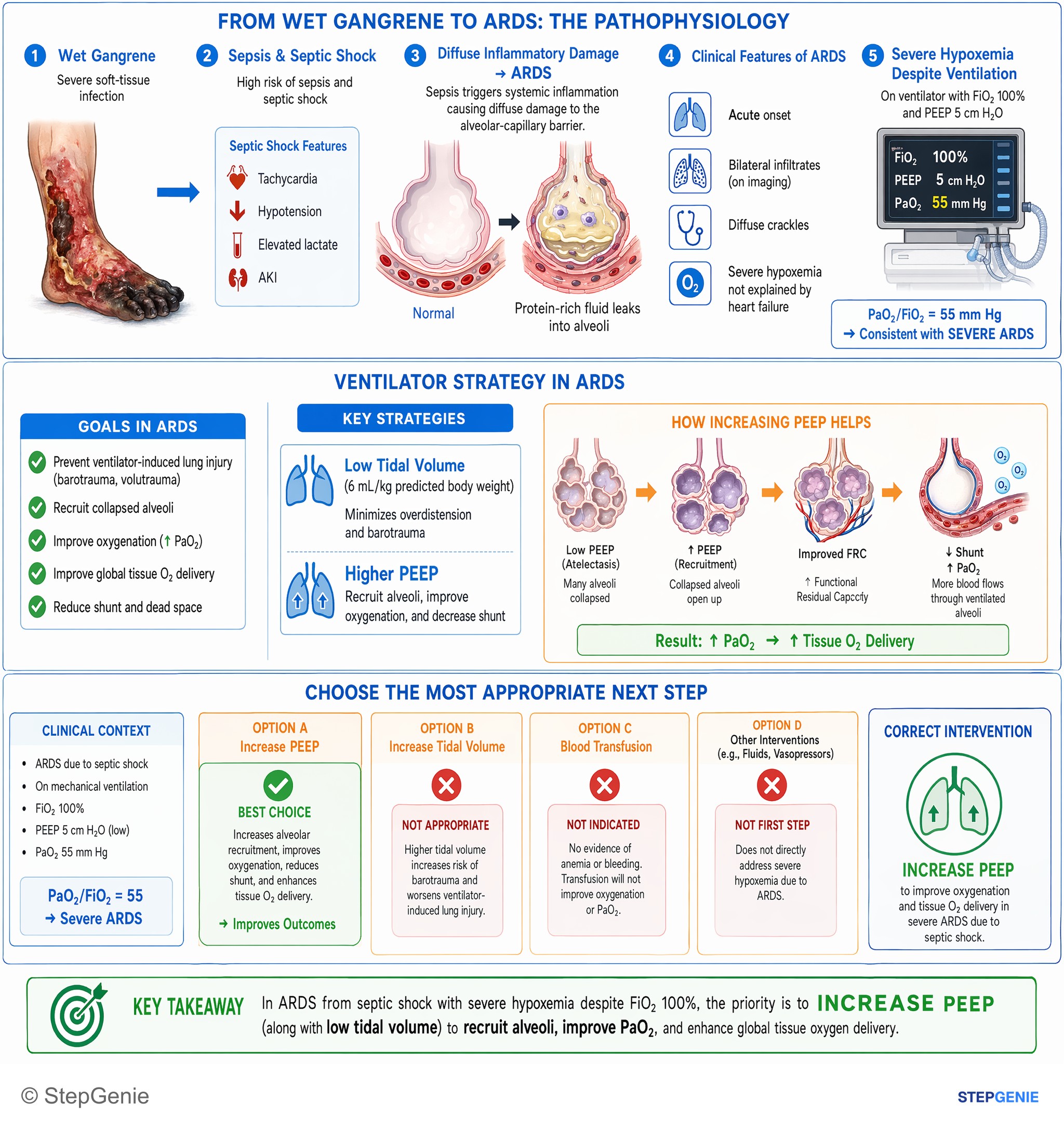 Critical care and trauma medicine — StepGenie USMLE Step 2 explanation infographic