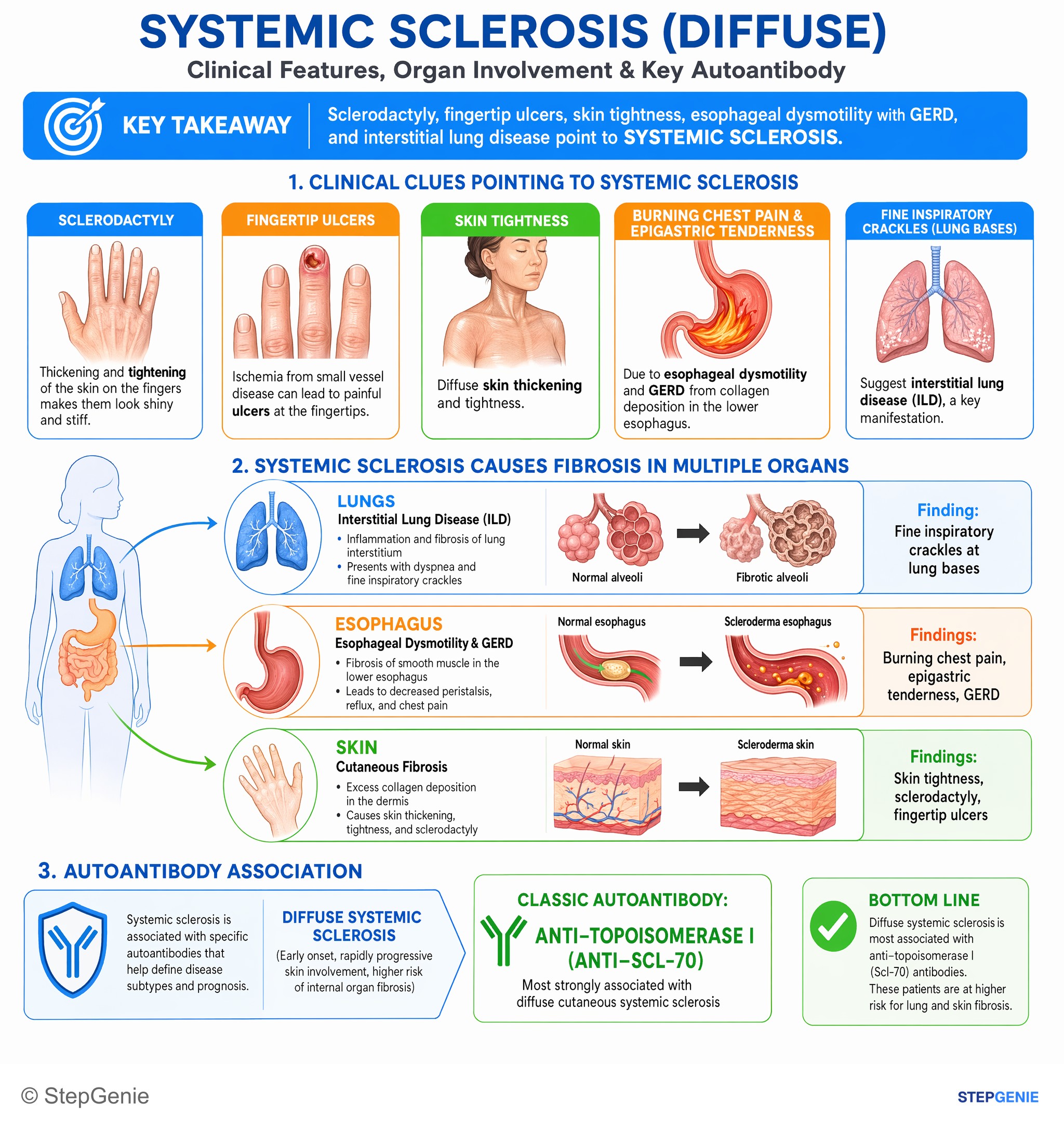 Gastroesophageal disorders — StepGenie USMLE Step 1 explanation infographic