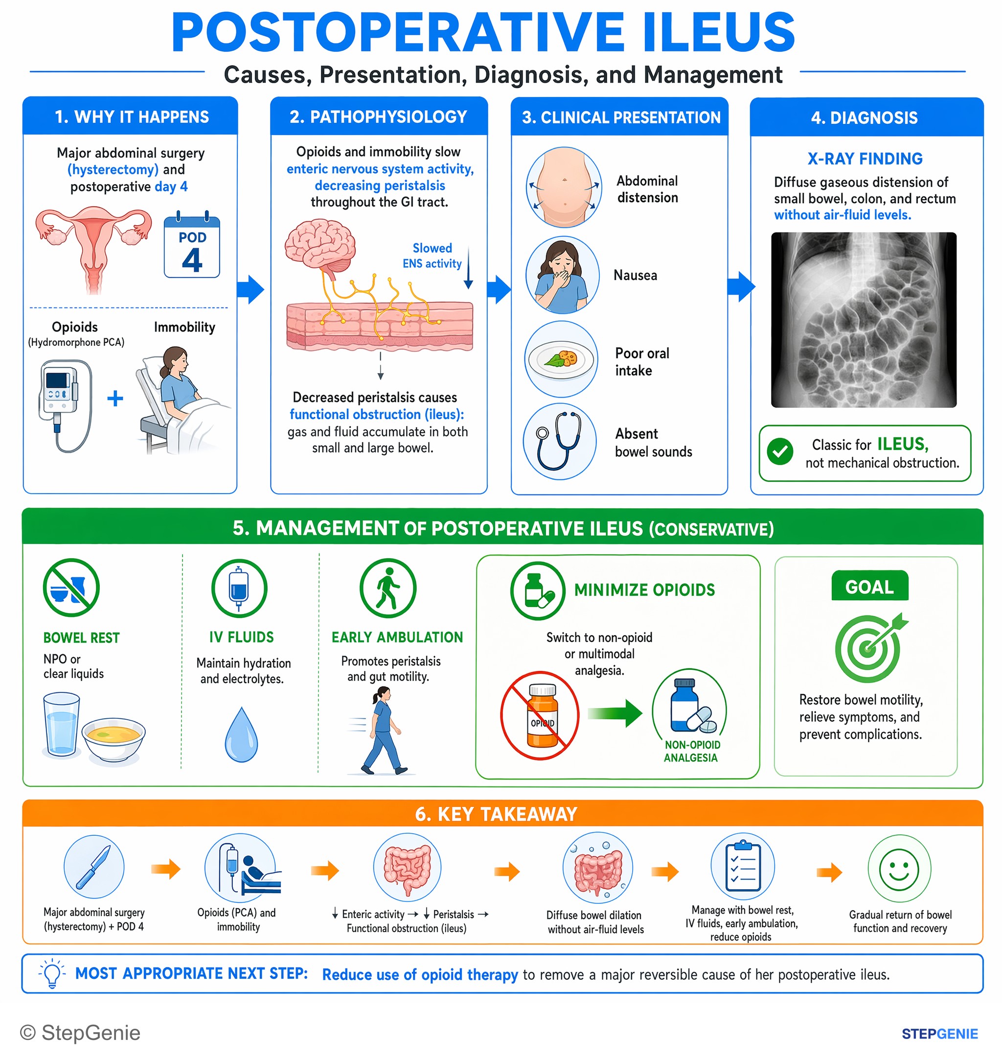 Intestinal and colorectal disorders — StepGenie USMLE Step 2 explanation infographic