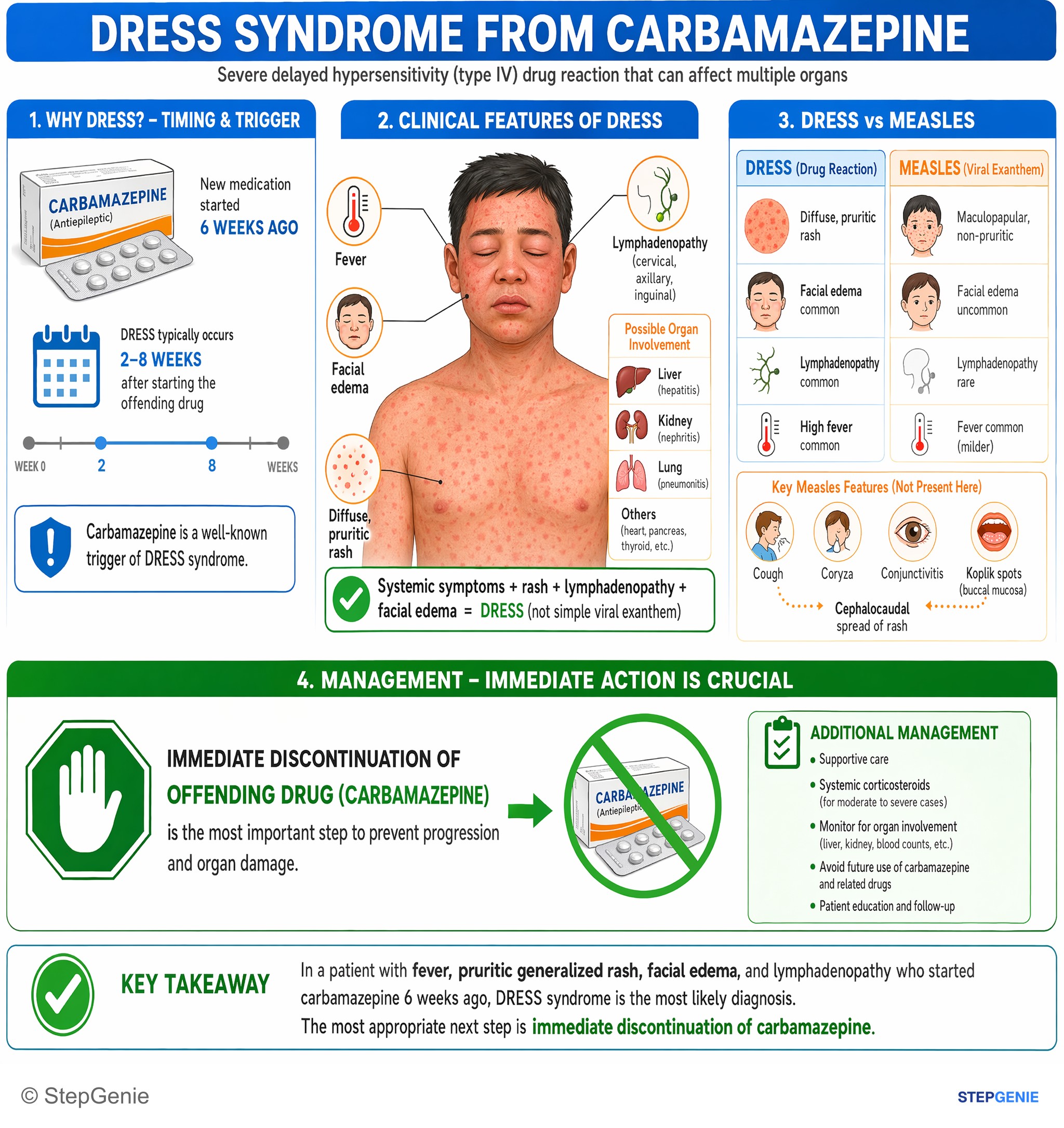 Anaphylaxis and allergic reactions — StepGenie USMLE Step 2 explanation infographic