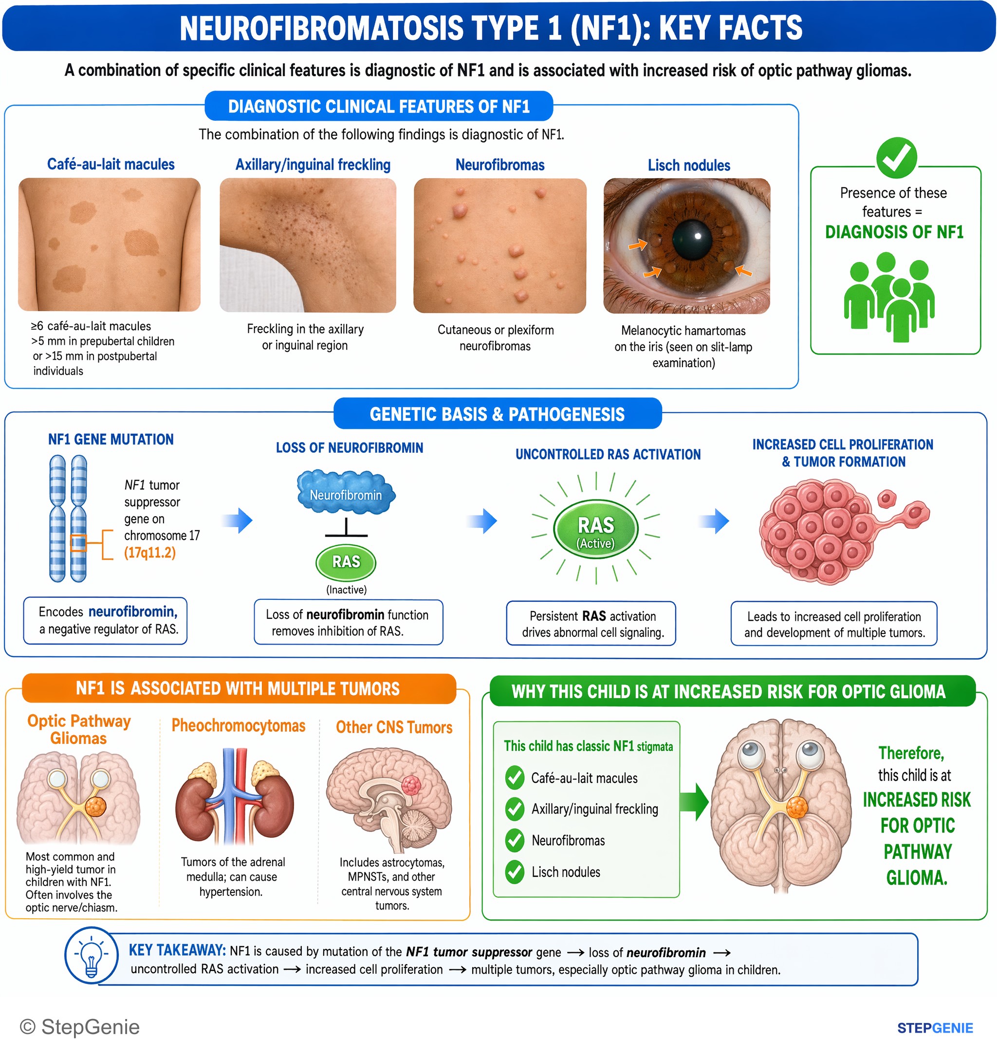 Tumors/Malignancy of the nervous system — StepGenie USMLE Step 1 explanation infographic