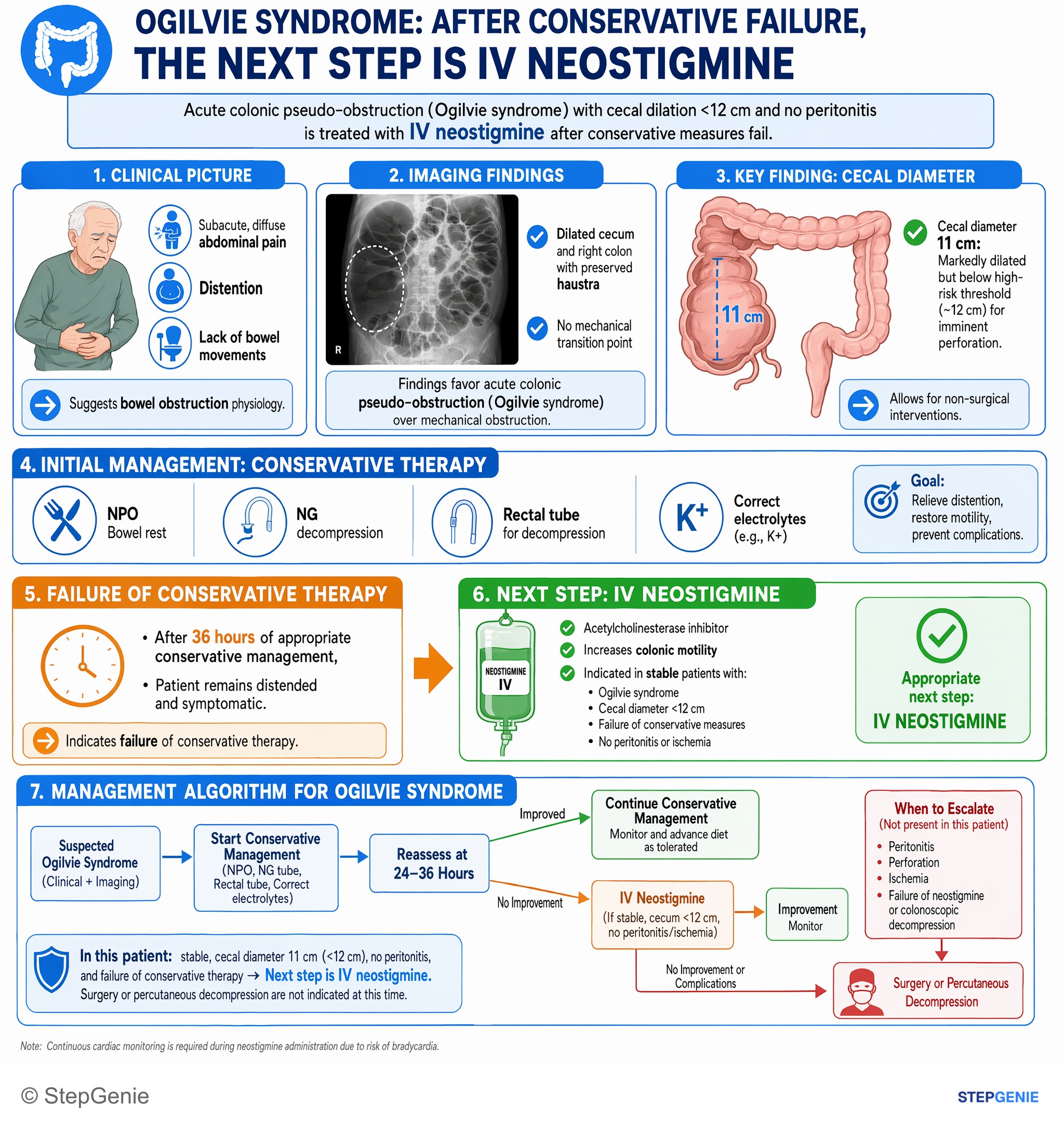 Intestinal and colorectal disorders — StepGenie USMLE Step 2 explanation infographic