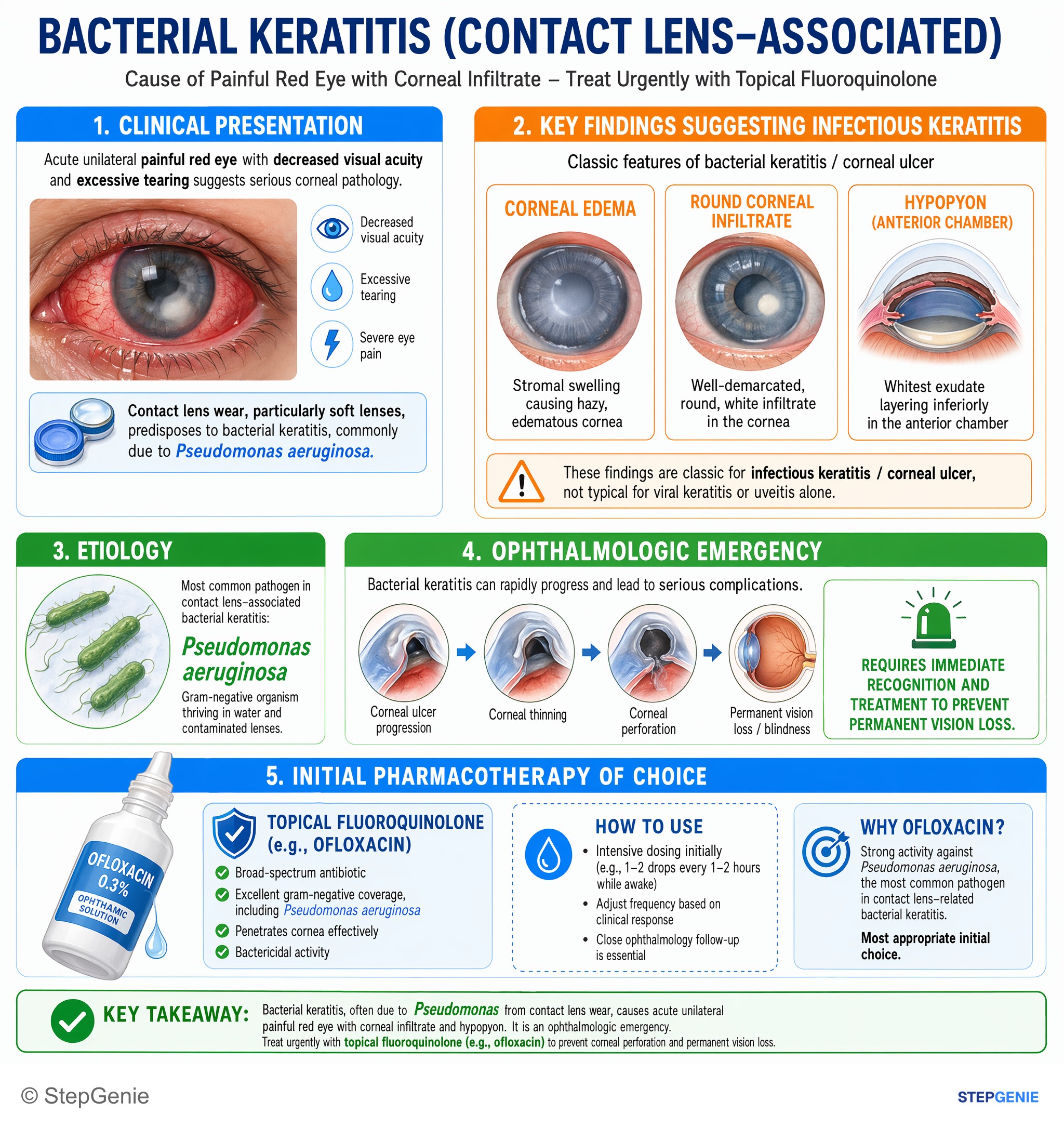 Step-by-step reasoning infographic: Bacterial keratitis (contact lens–associated, often Pseudomonas) causes painful red eye with corneal infiltrate; treat urgently with topical…