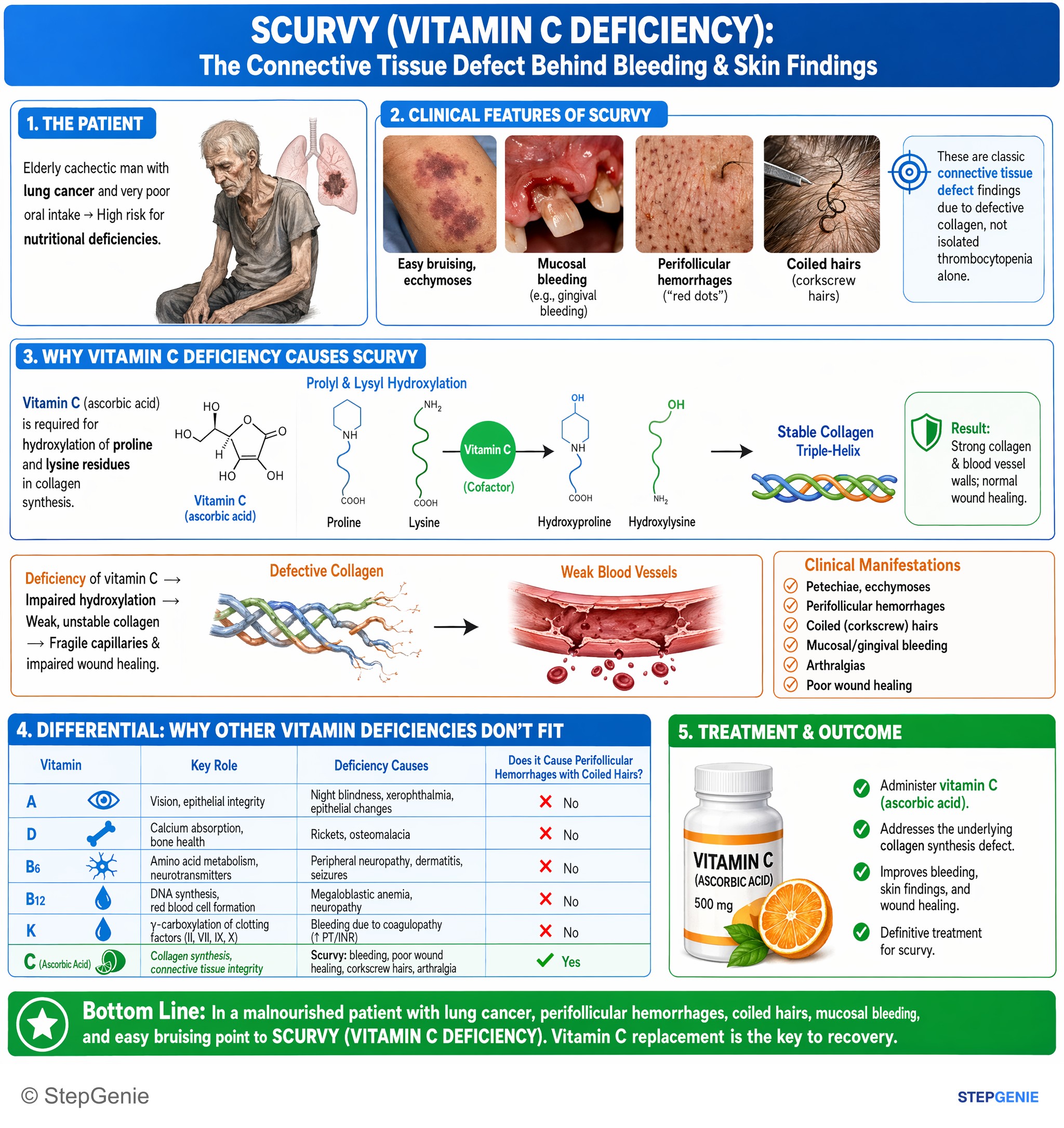 Disorders of nutrition — StepGenie USMLE Step 1 explanation infographic