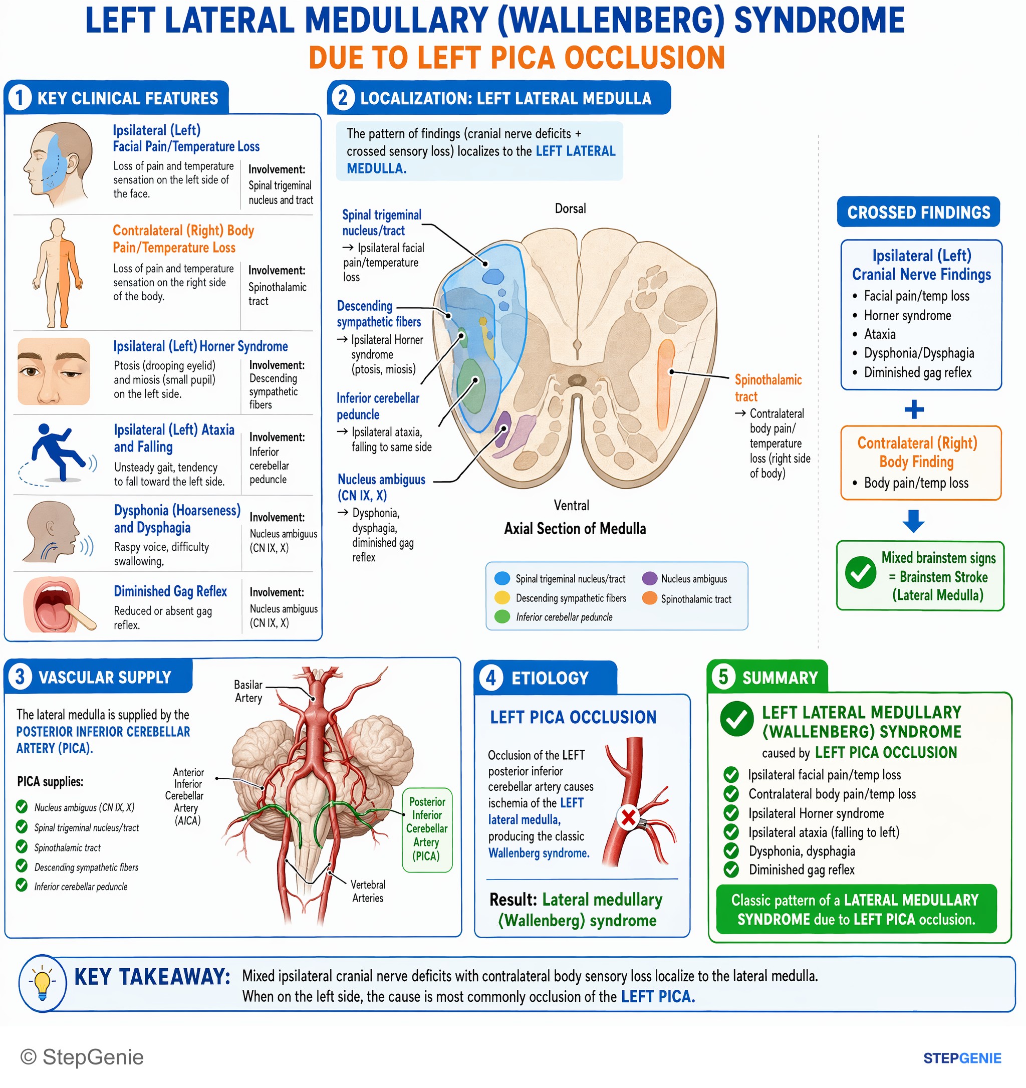 Strokes & Stroke-related stuff — StepGenie USMLE Step 1 explanation infographic