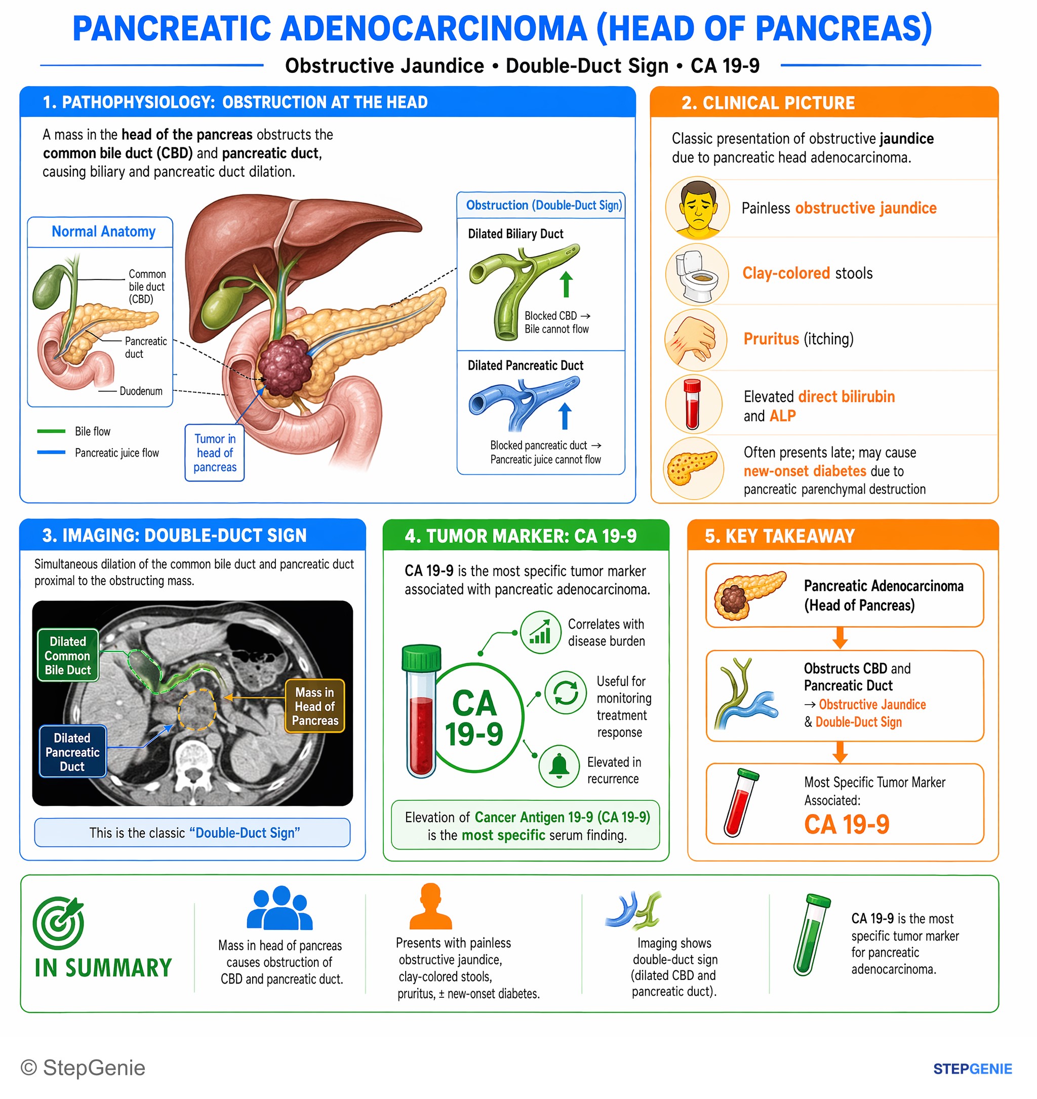 Pancreatic disorders — StepGenie USMLE Step 1 explanation infographic
