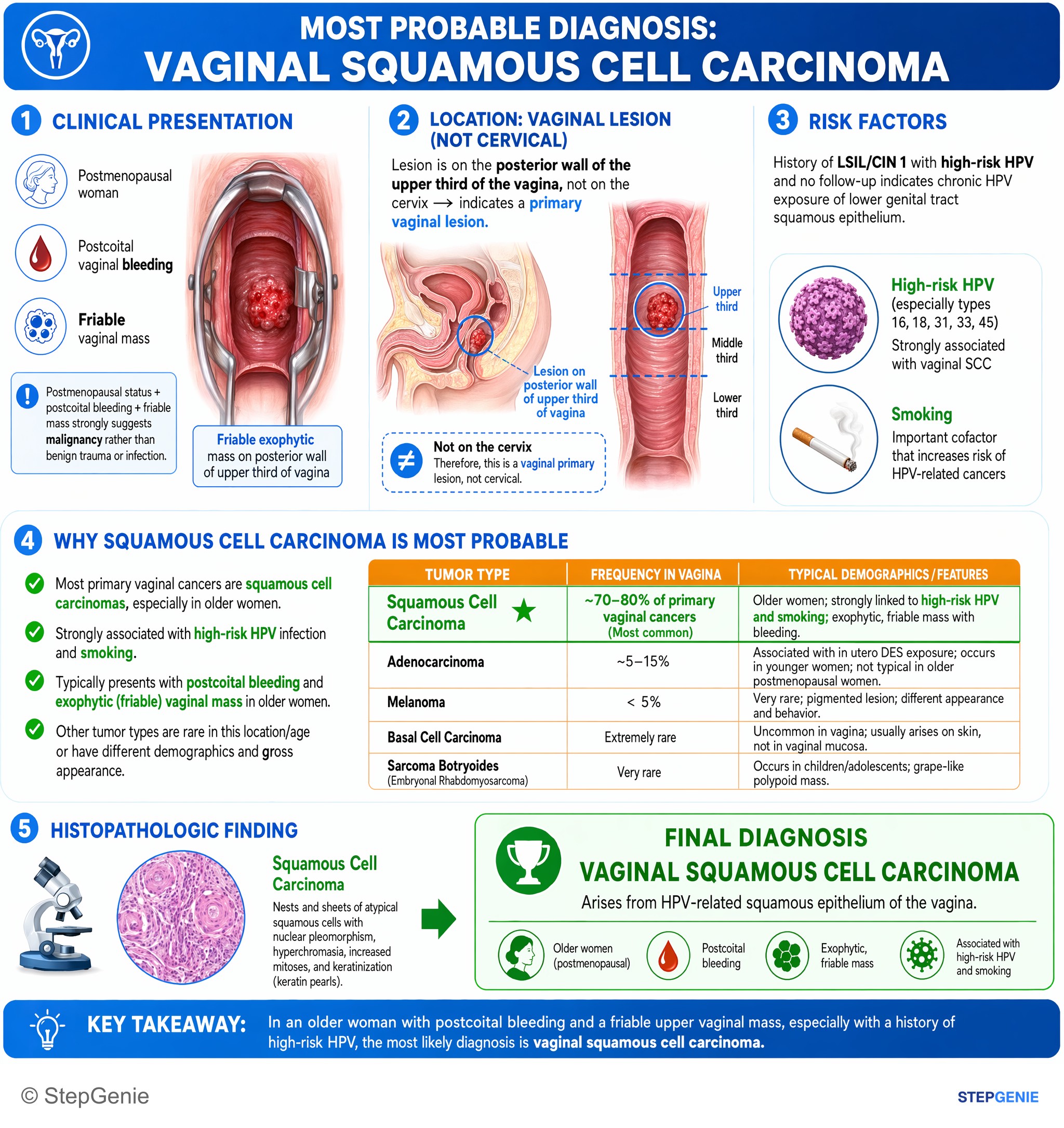 Gynecologic tumors / malignancy — StepGenie USMLE Step 1 explanation infographic