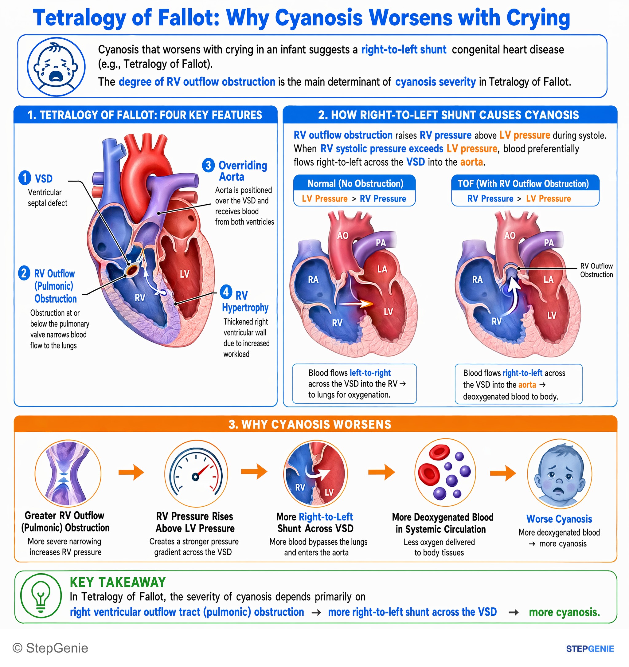 Congenital heart disease — StepGenie USMLE Step 1 explanation infographic