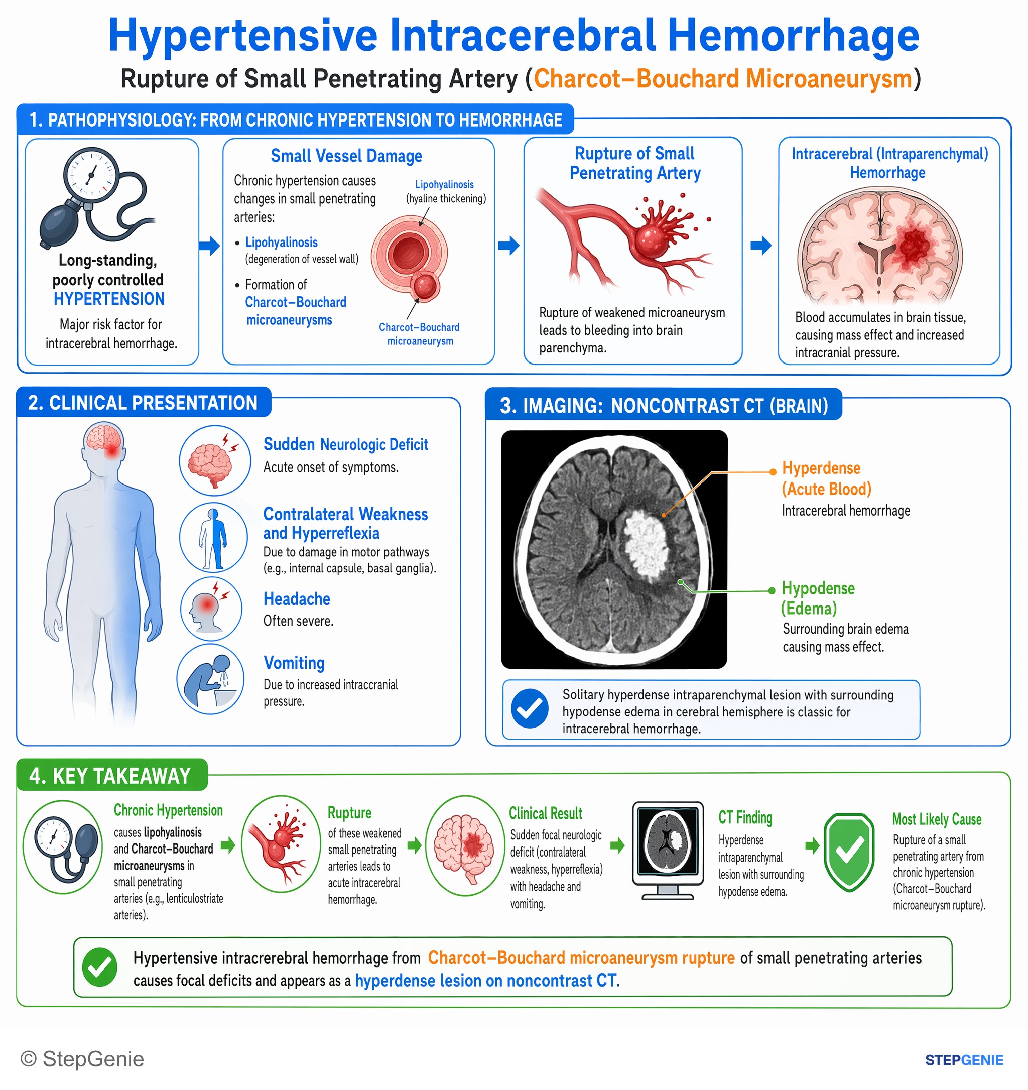 Strokes & Stroke-related stuff — StepGenie USMLE Step 1 explanation infographic