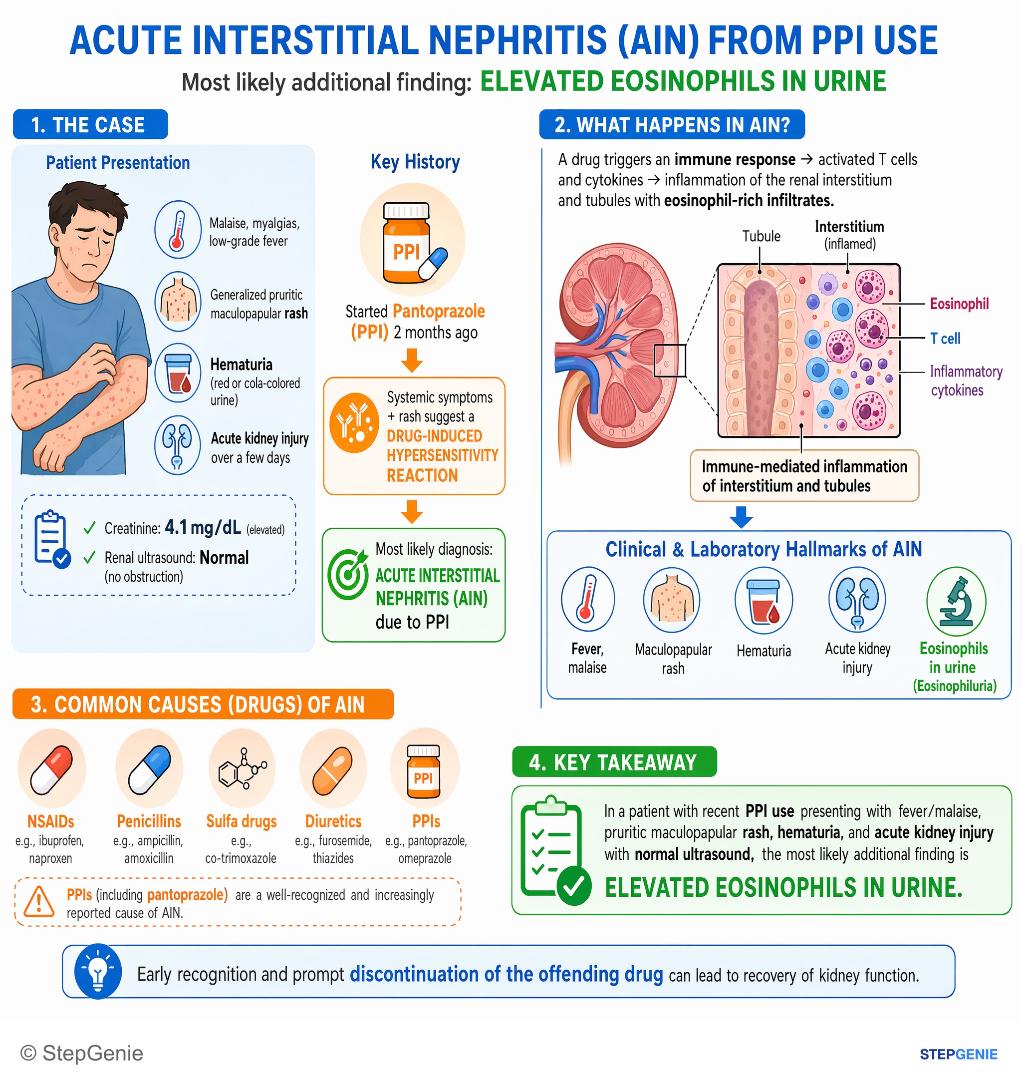 Acute kidney injury — StepGenie USMLE Step 1 explanation infographic