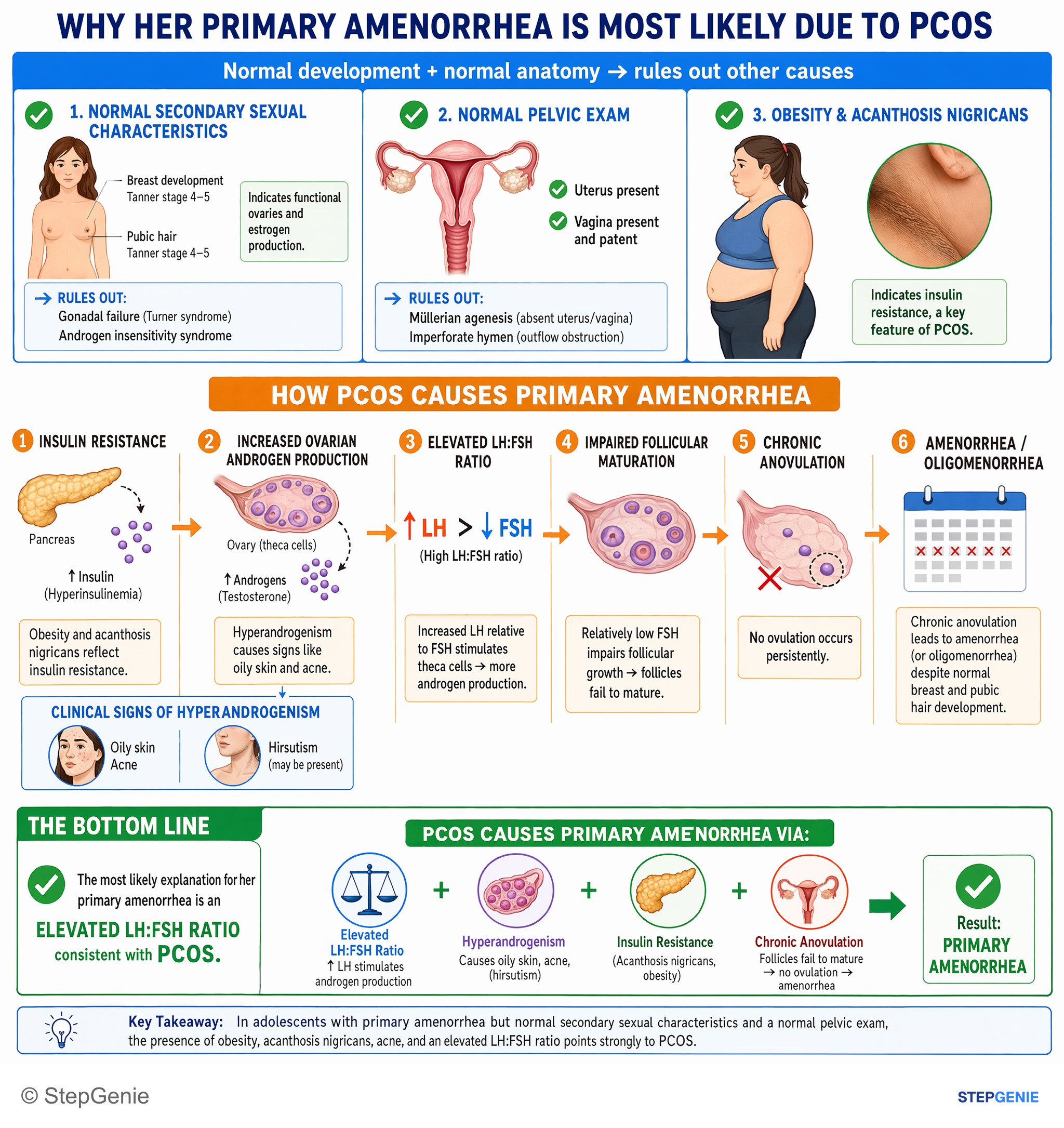 Step-by-step reasoning infographic: Polycystic ovary syndrome (PCOS) causes primary amenorrhea via chronic anovulation from elevated LH:FSH ratio, hyperandrogenism, and insulin…