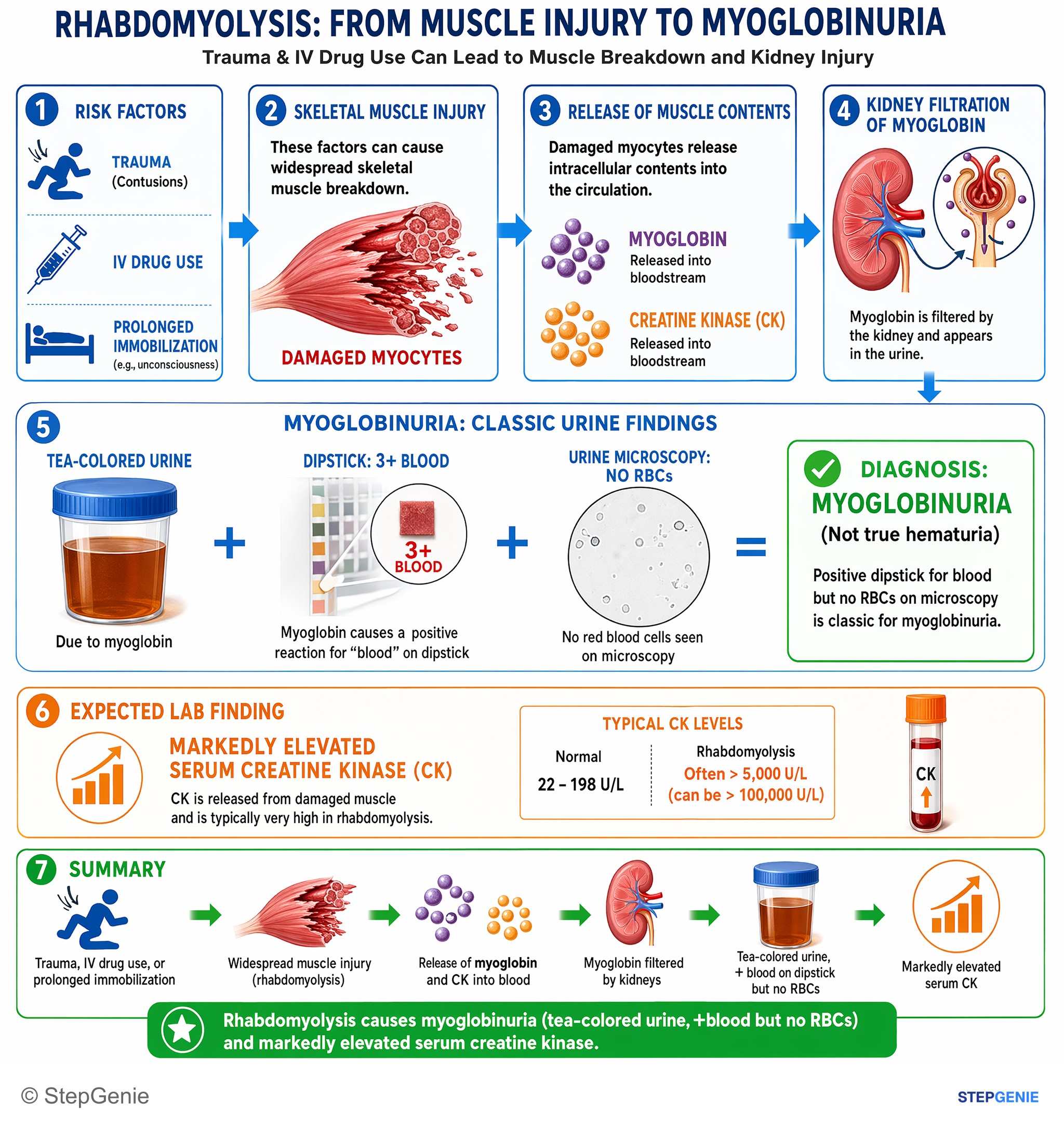Acute kidney injury — StepGenie USMLE Step 2 explanation infographic
