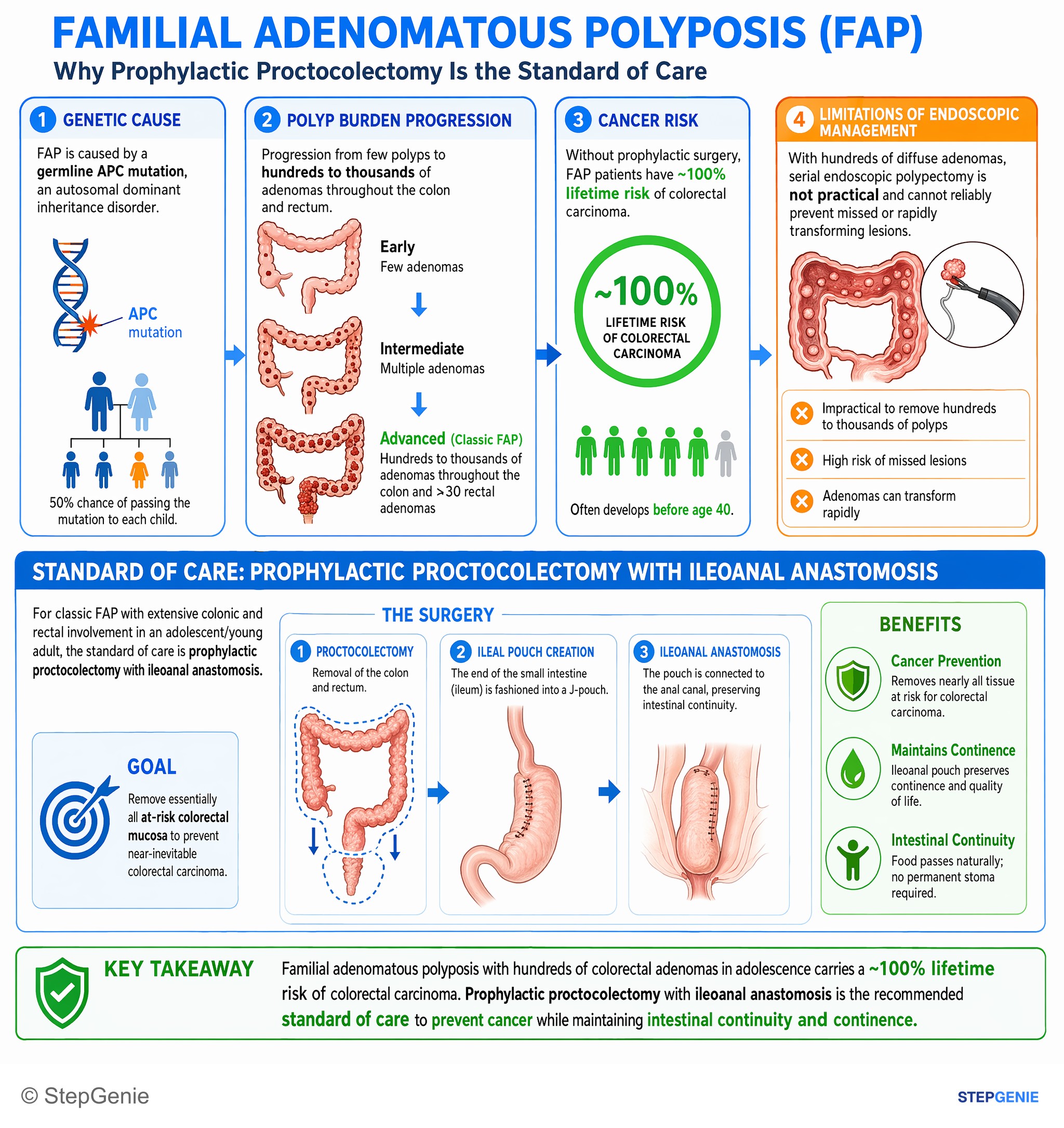Tumors of the GI tract — StepGenie USMLE Step 2 explanation infographic