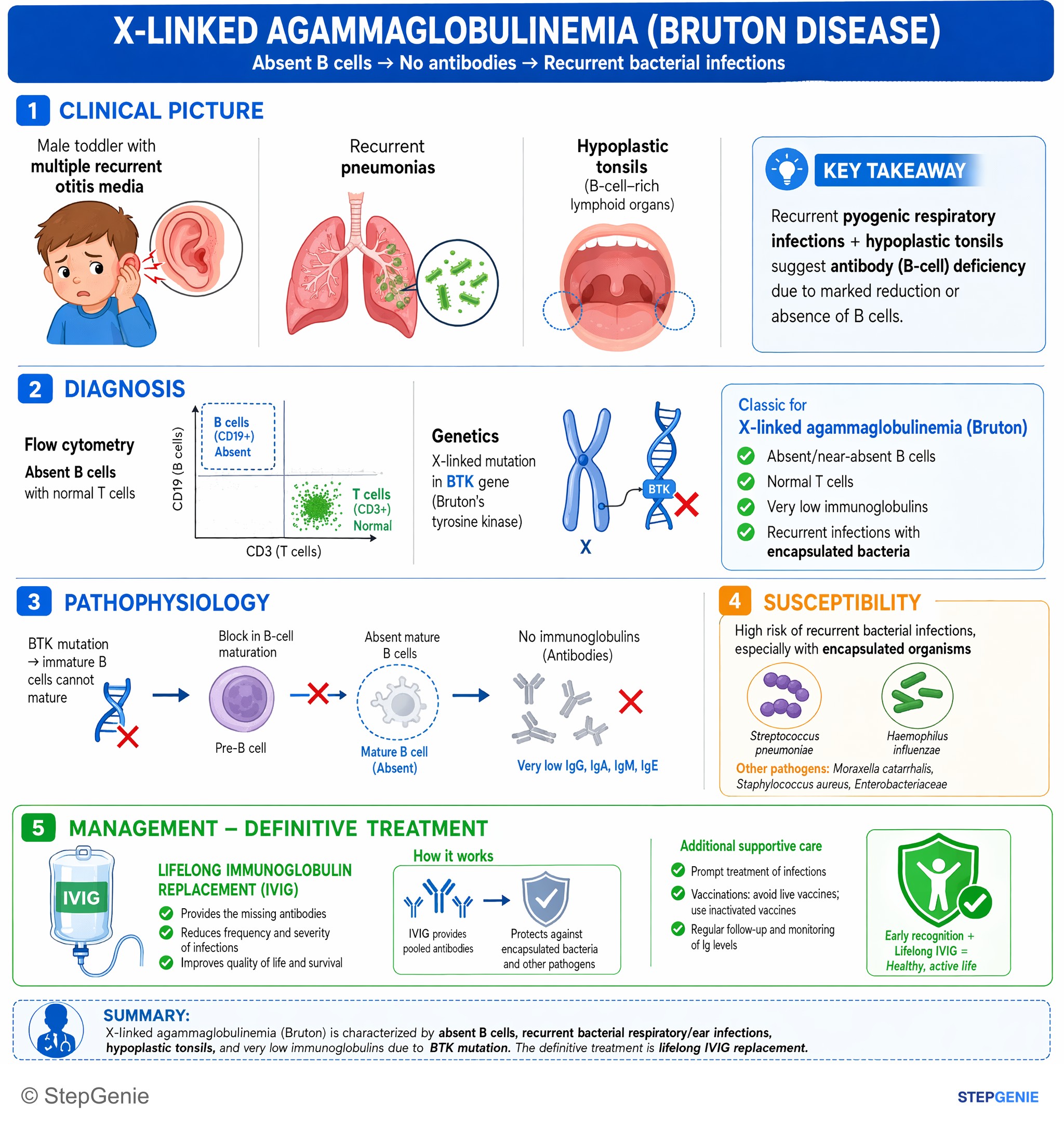 Immune deficiencies — StepGenie USMLE Step 2 explanation infographic