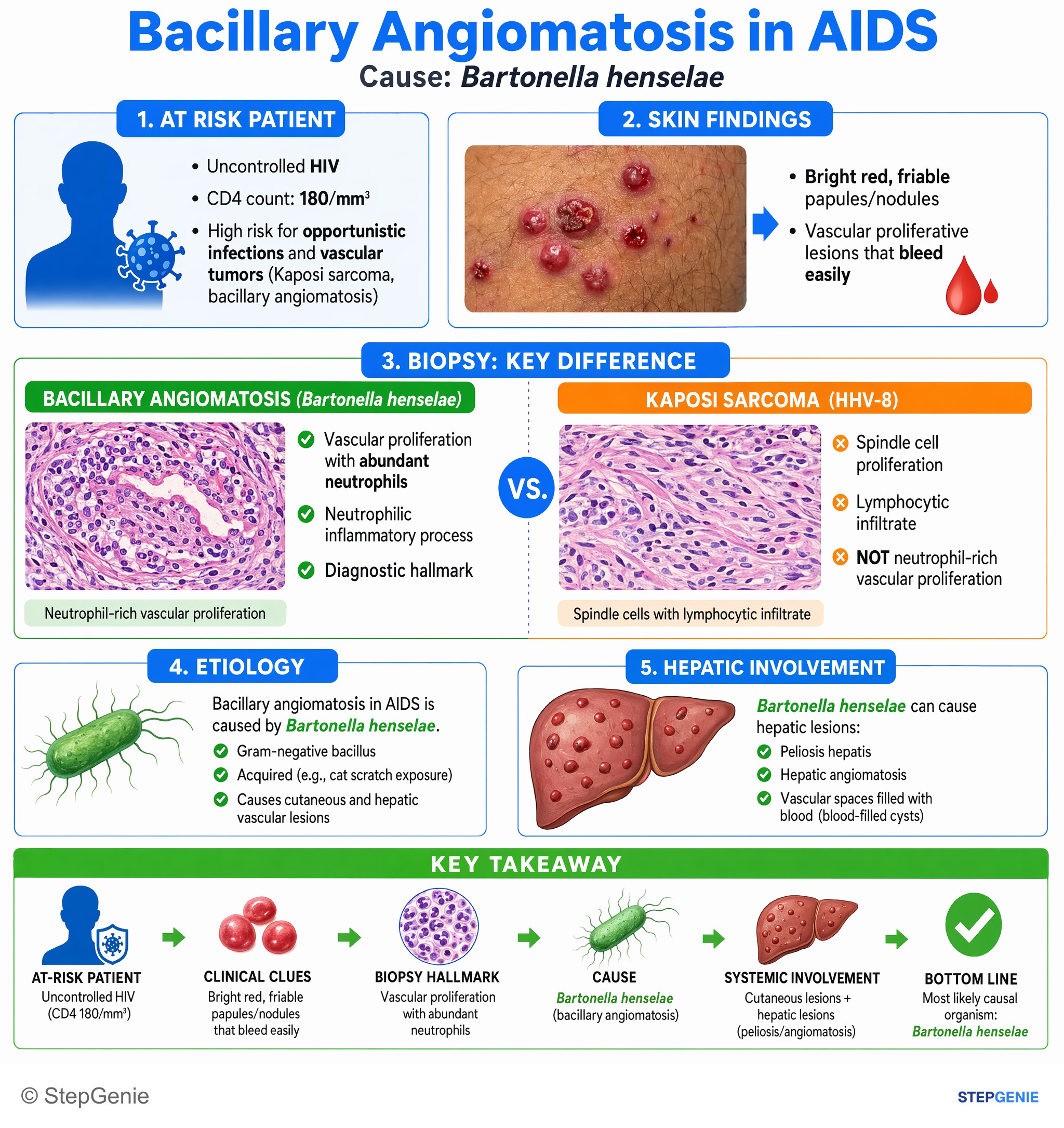 Bacterial infections — StepGenie USMLE Step 1 explanation infographic