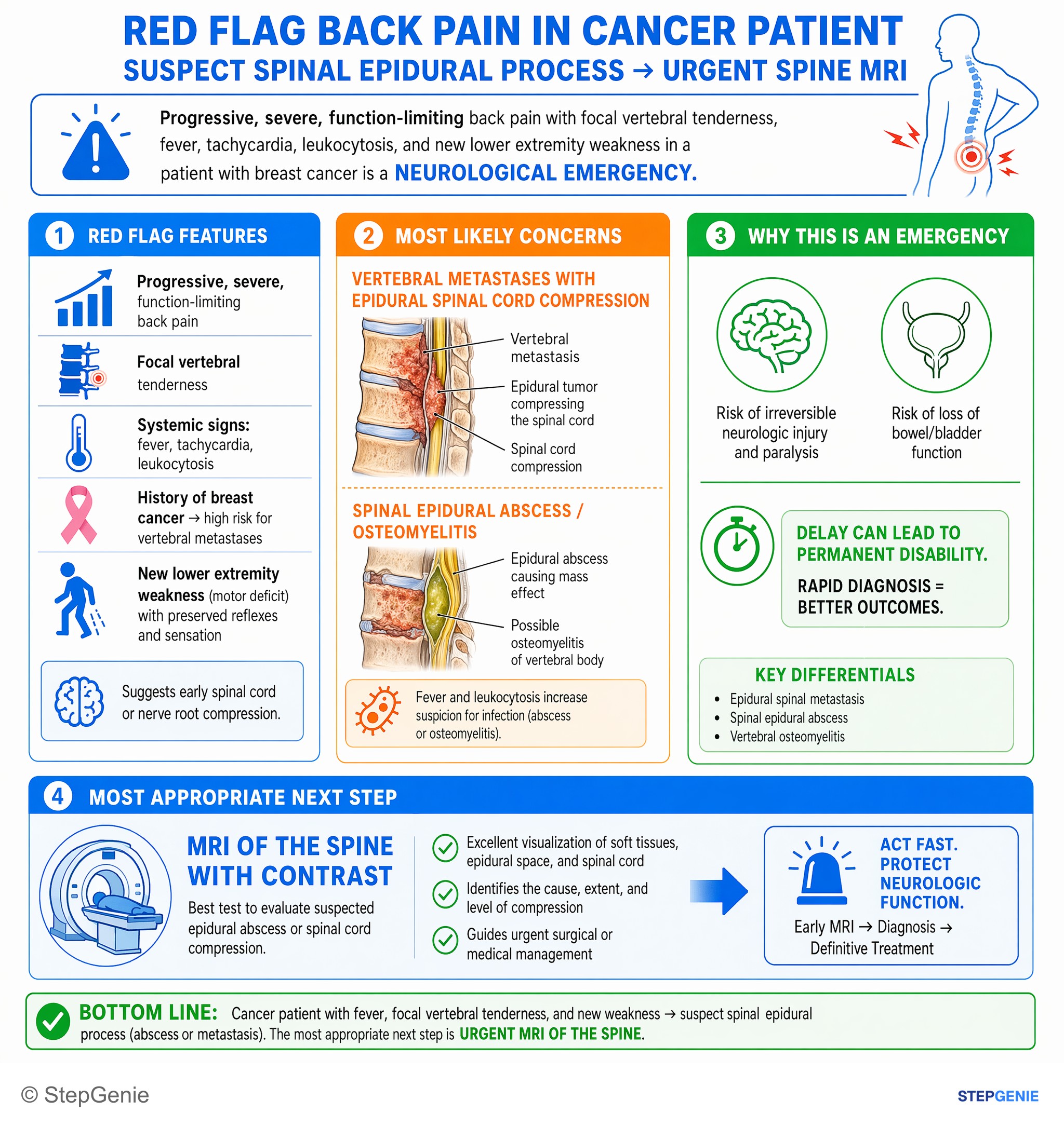 Step-by-step reasoning infographic: Spinal epidural process (abscess or metastasis) suspected in cancer patient with fever, focal vertebral tenderness, and new weakness → urgent spine…