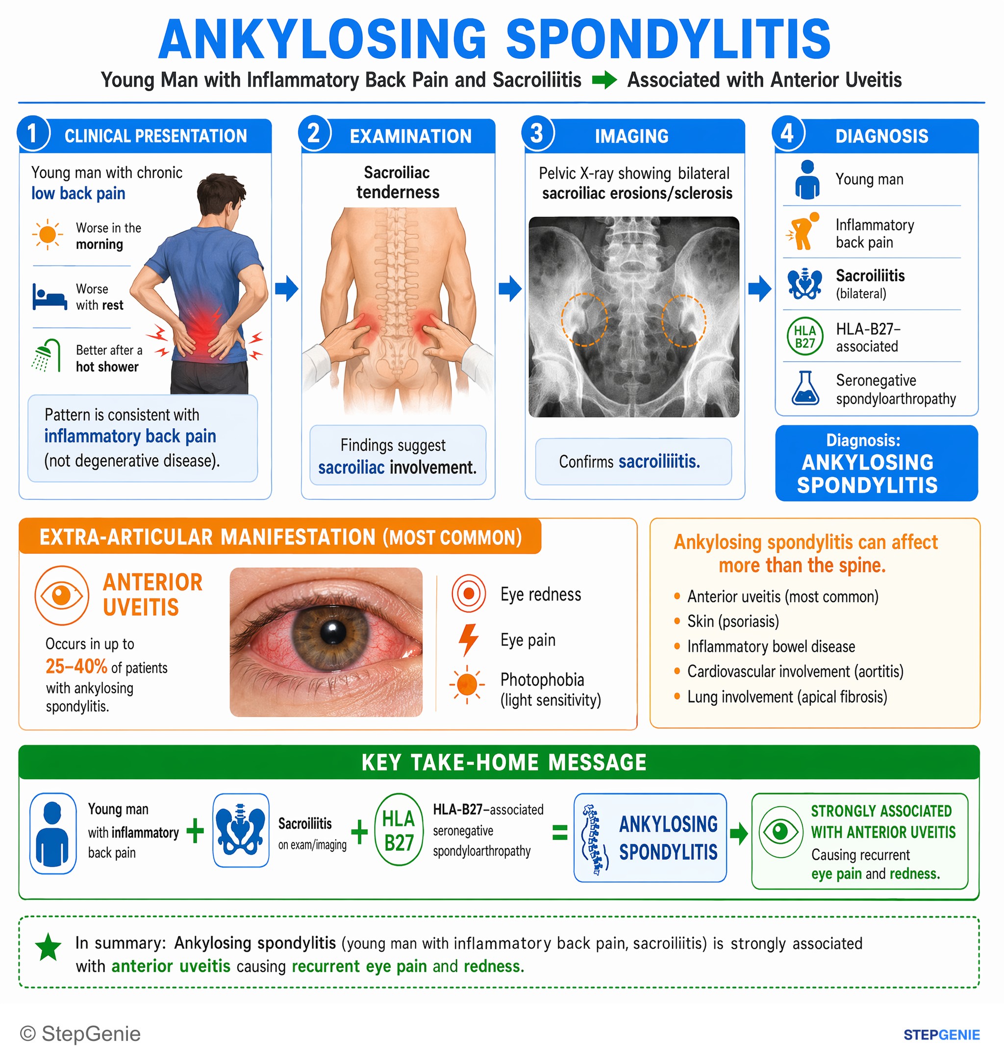 Arthritis and spondyloarthropathies — StepGenie USMLE Step 1 explanation infographic