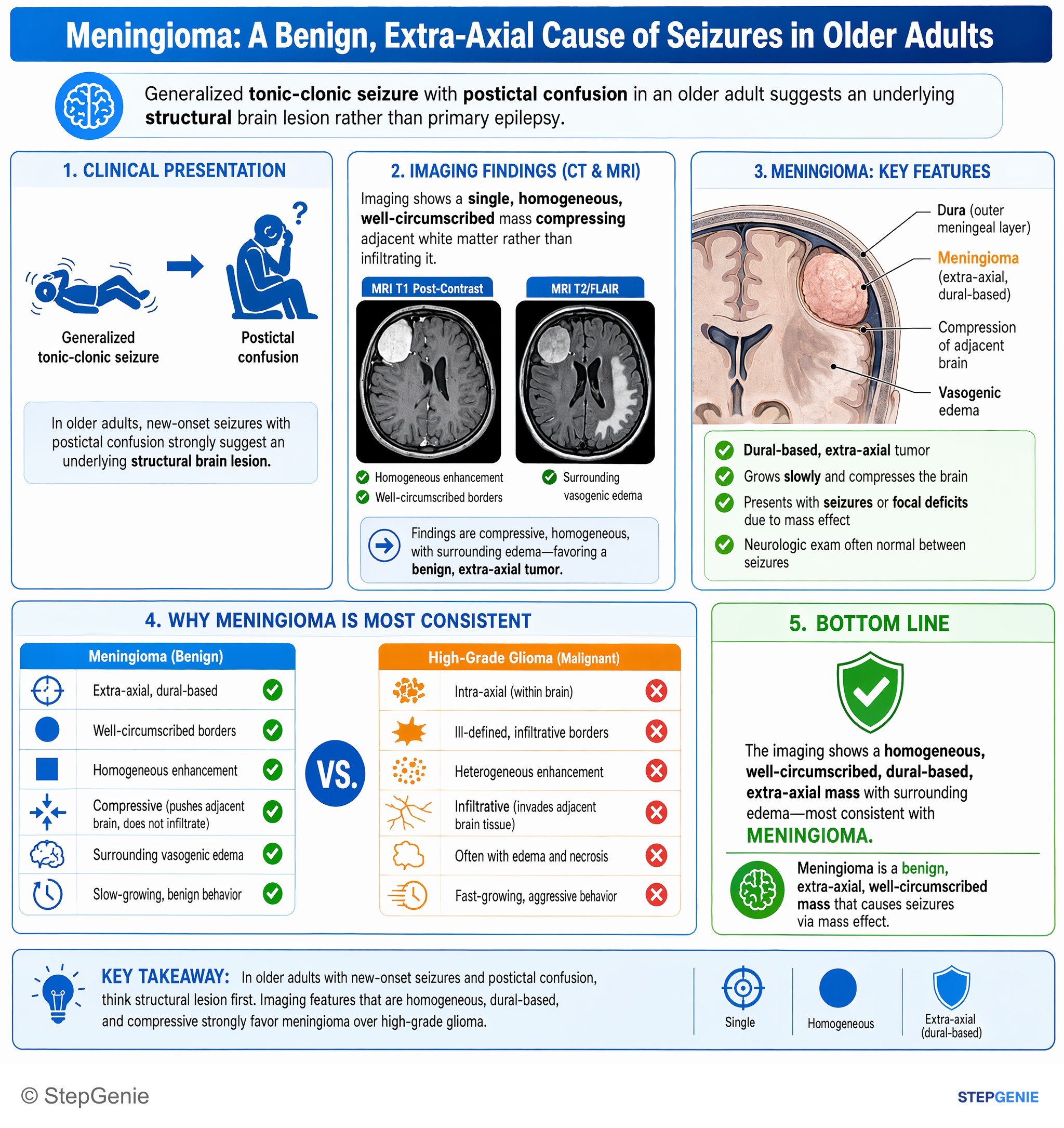 Tumors of the nervous system — StepGenie USMLE Step 2 explanation infographic