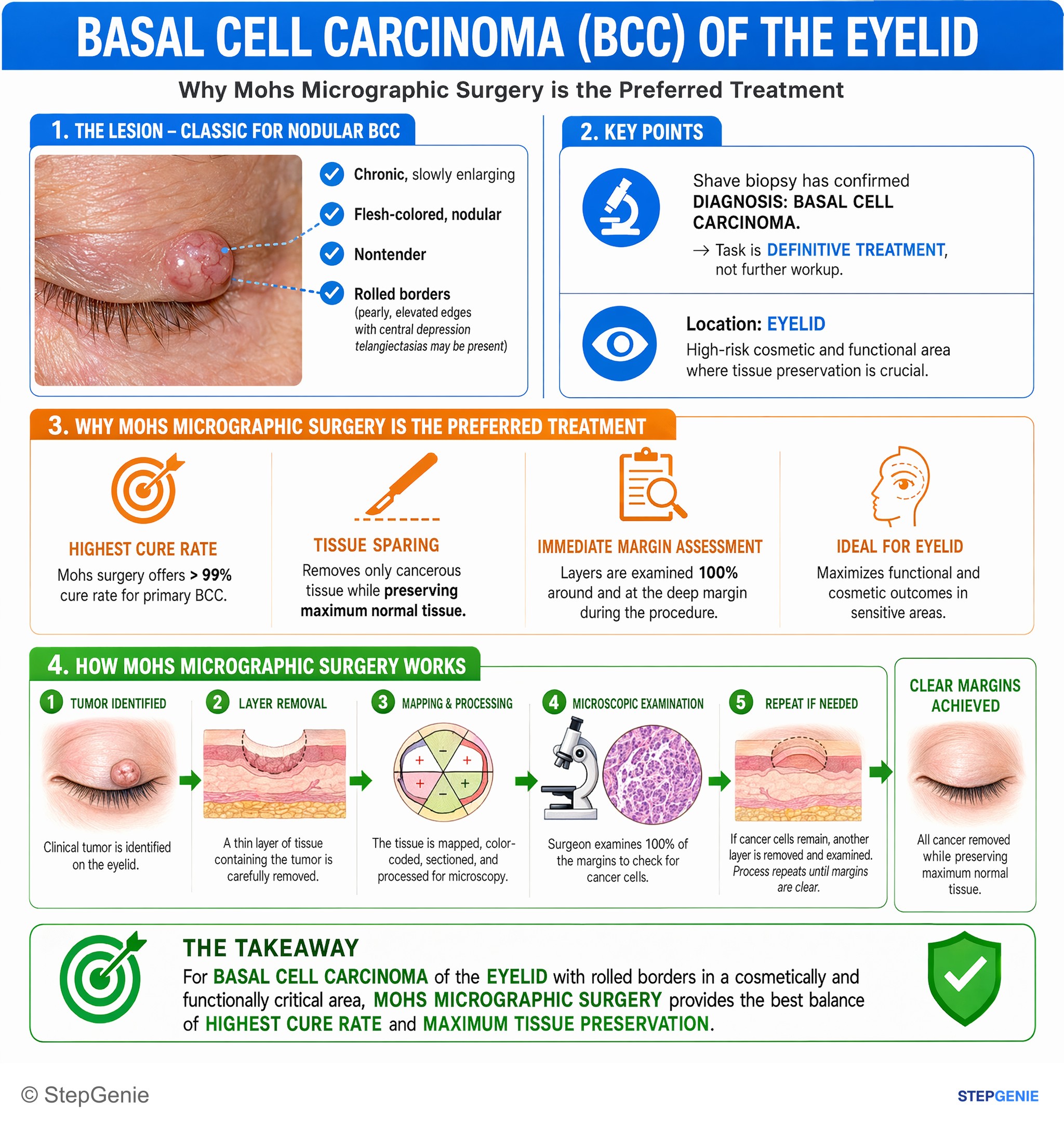Disorders of the eye and associated structures — StepGenie USMLE Step 2 explanation infographic