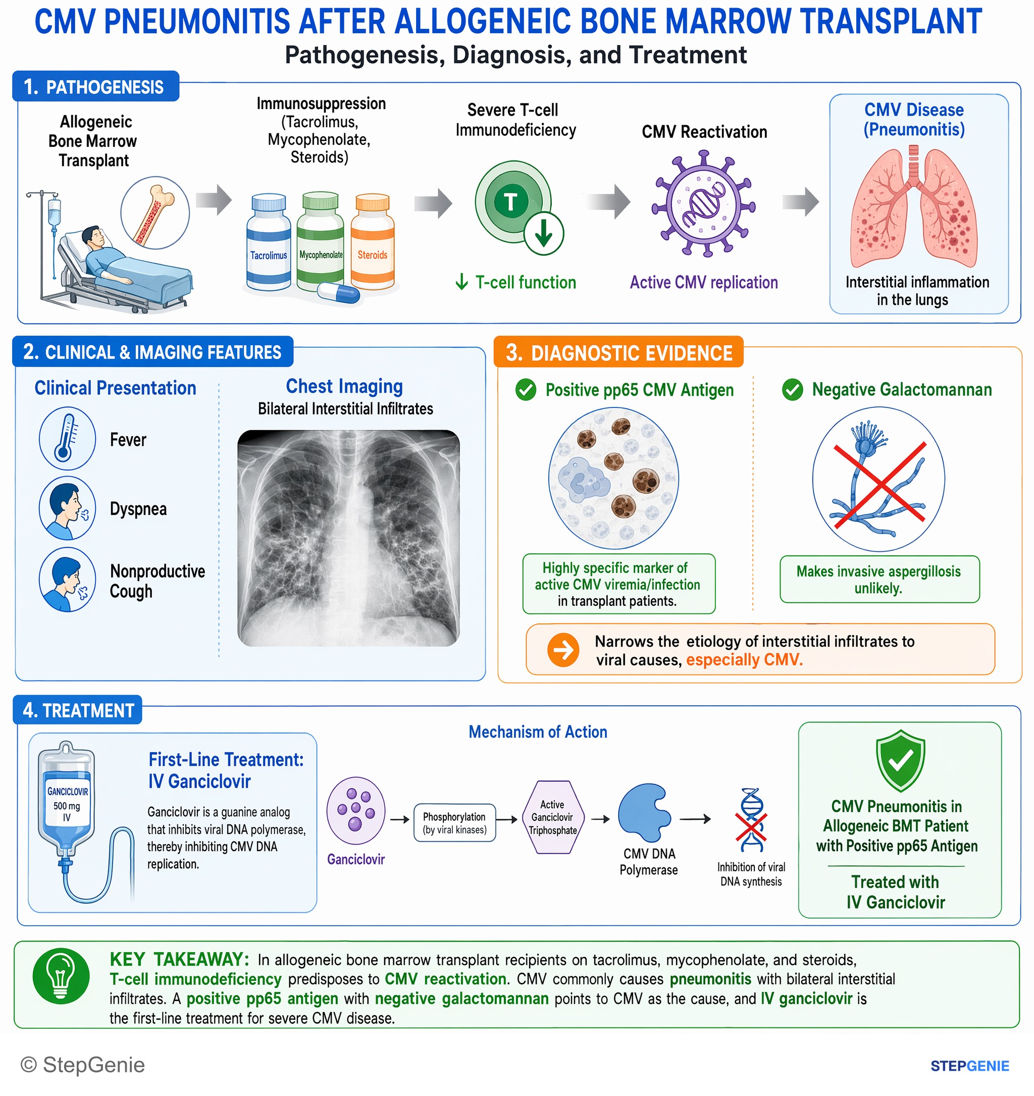 Viral infections — StepGenie USMLE Step 2 explanation infographic