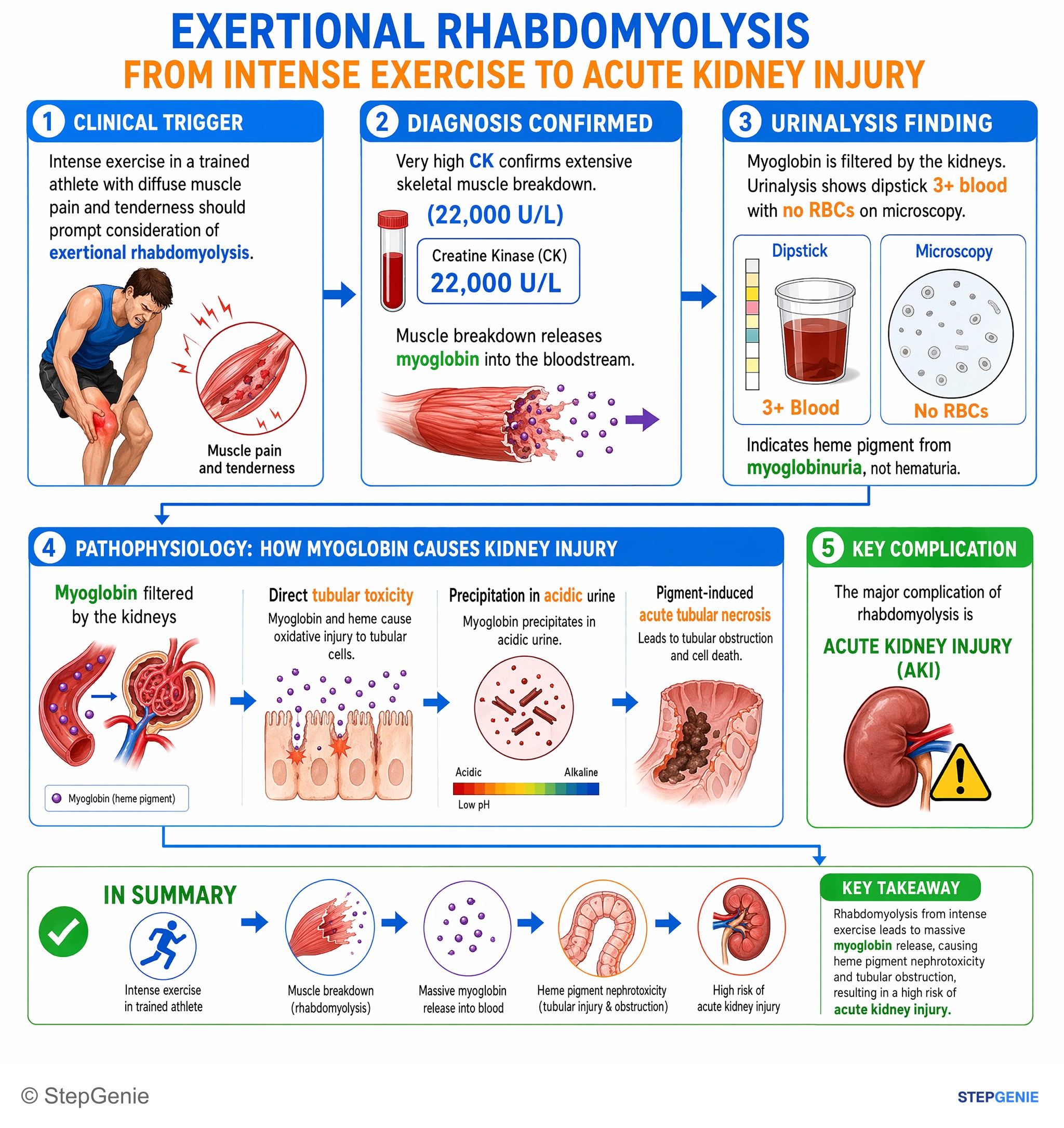 Acute kidney injury — StepGenie USMLE Step 1 explanation infographic