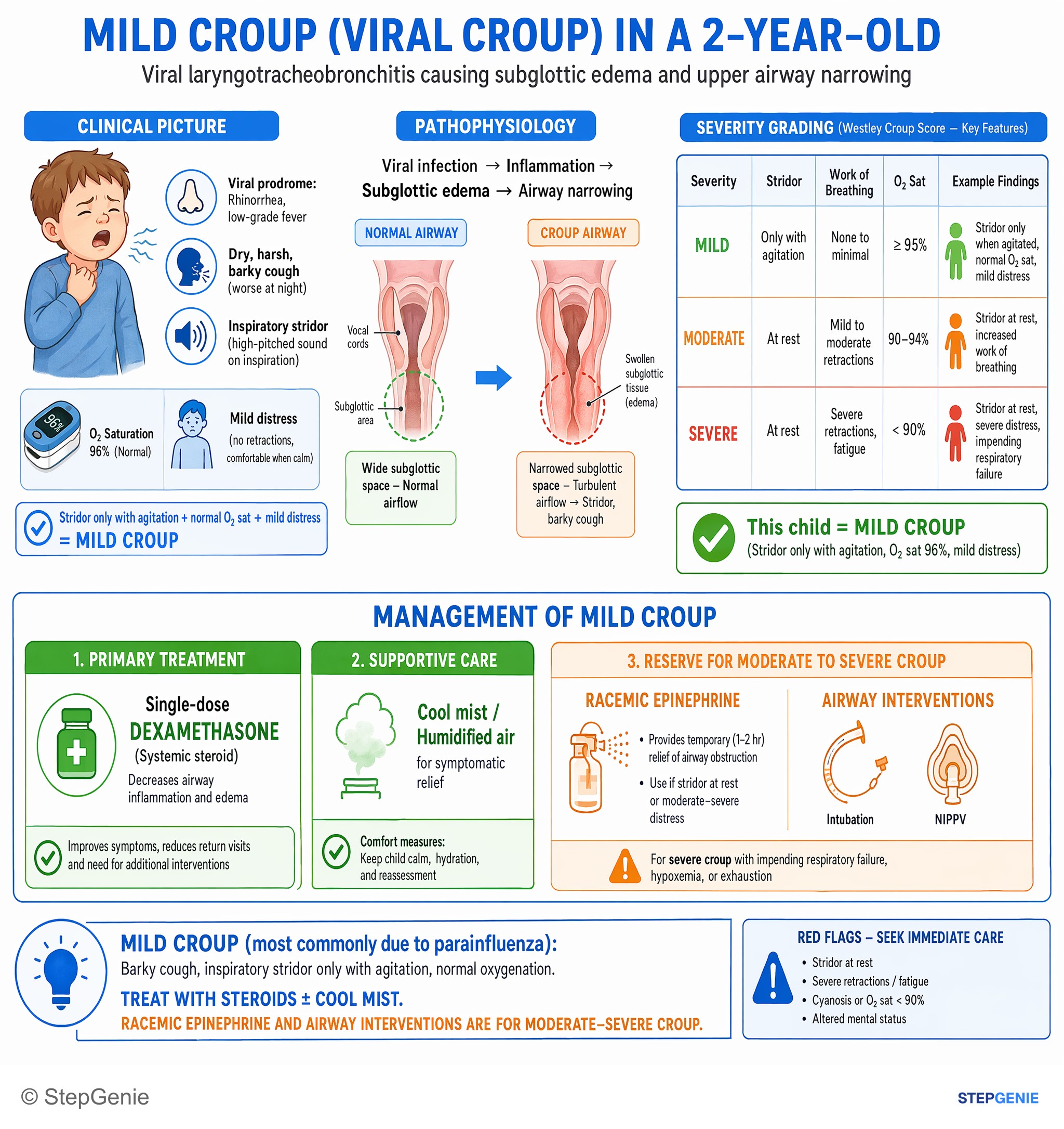 Step-by-step reasoning infographic: Mild croup (parainfluenza): barky cough, inspiratory stridor only with agitation → treat with steroids ± cool mist; racemic epinephrine for…