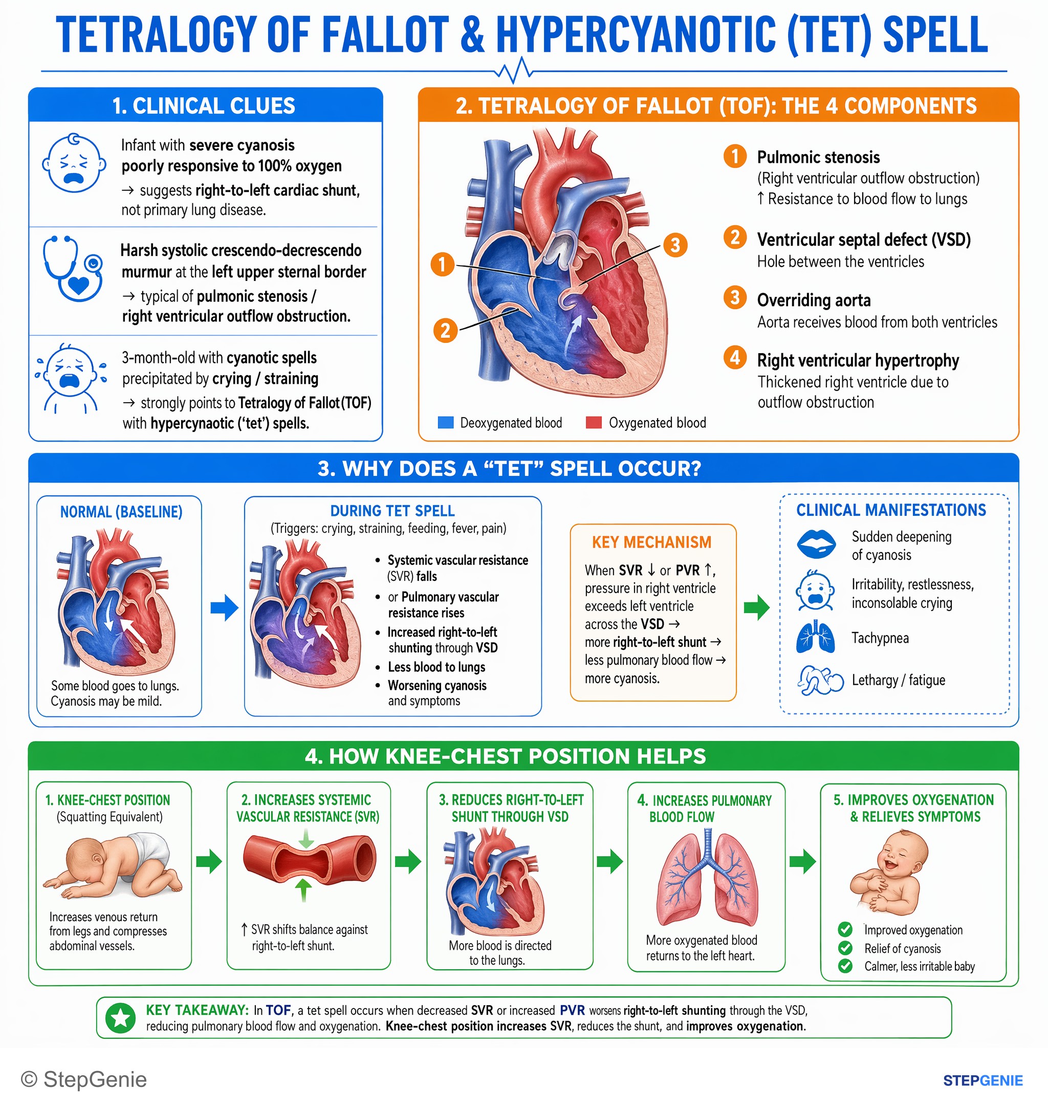 Congenital heart disease — StepGenie USMLE Step 2 explanation infographic