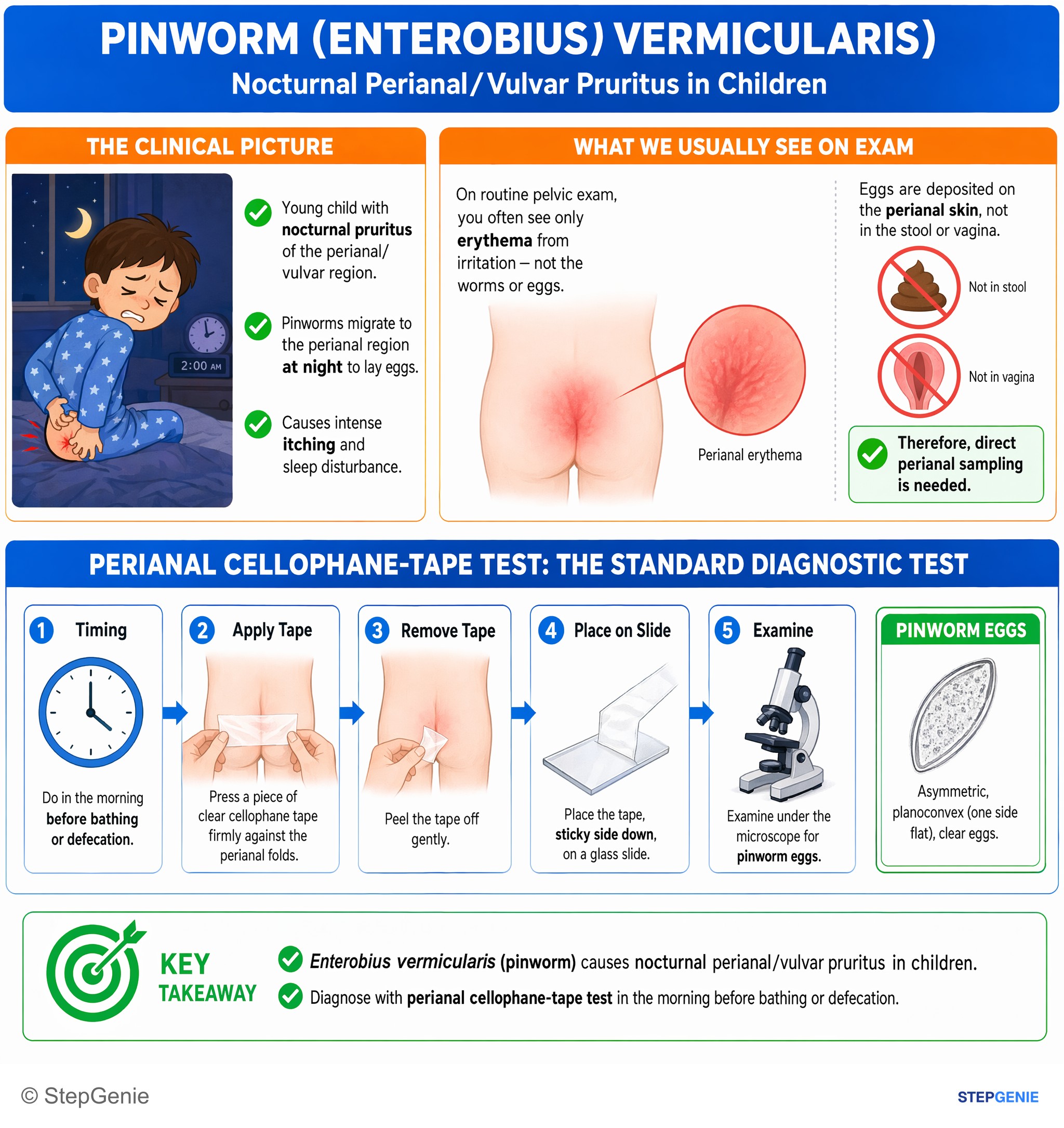 Parasitic and helminthic infections — StepGenie USMLE Step 2 explanation infographic
