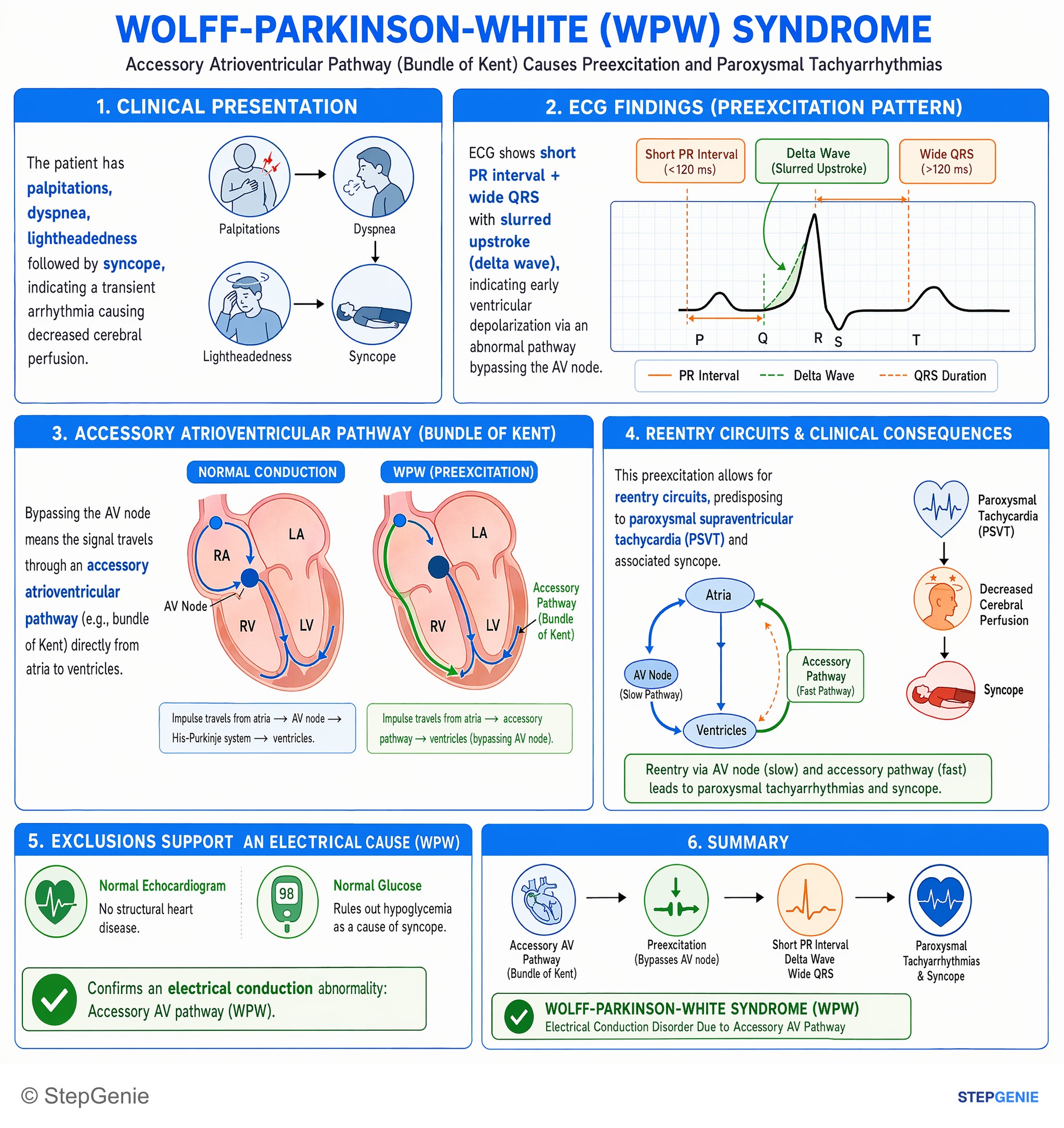 Cardiac arrhythmias — StepGenie USMLE Step 1 explanation infographic