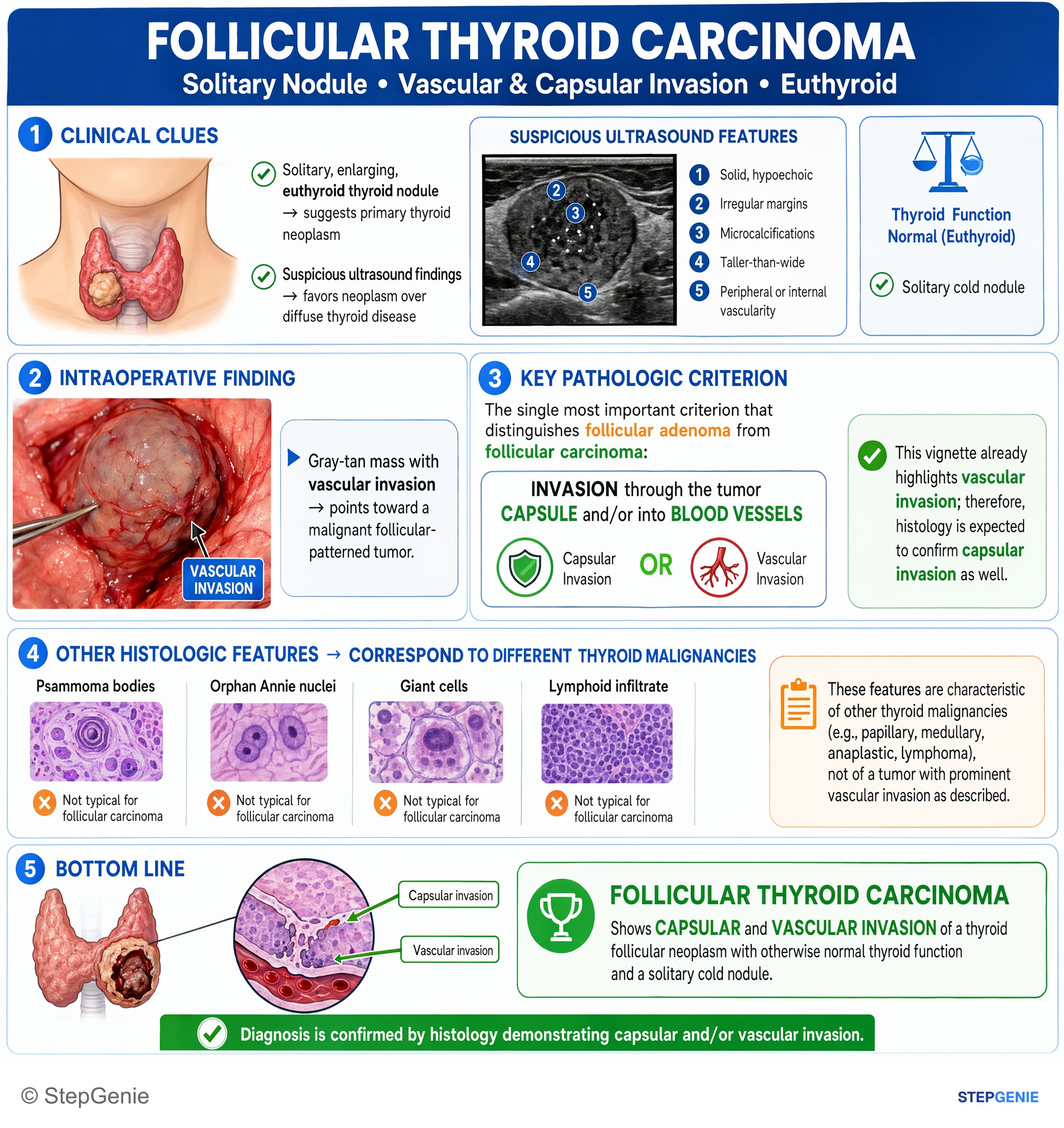 Endocrine tumors — StepGenie USMLE Step 1 explanation infographic