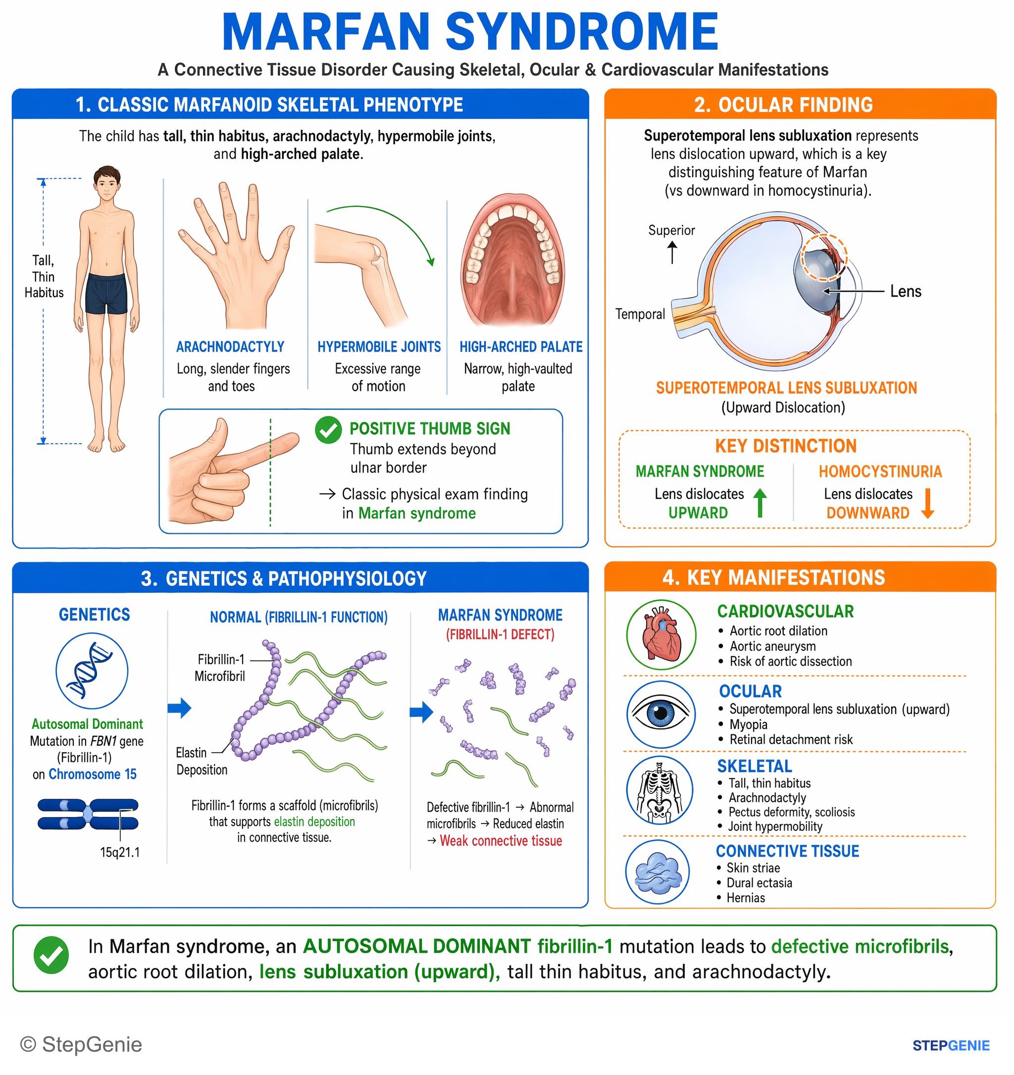 Collagen / Connective tissue disorders — StepGenie USMLE Step 1 explanation infographic