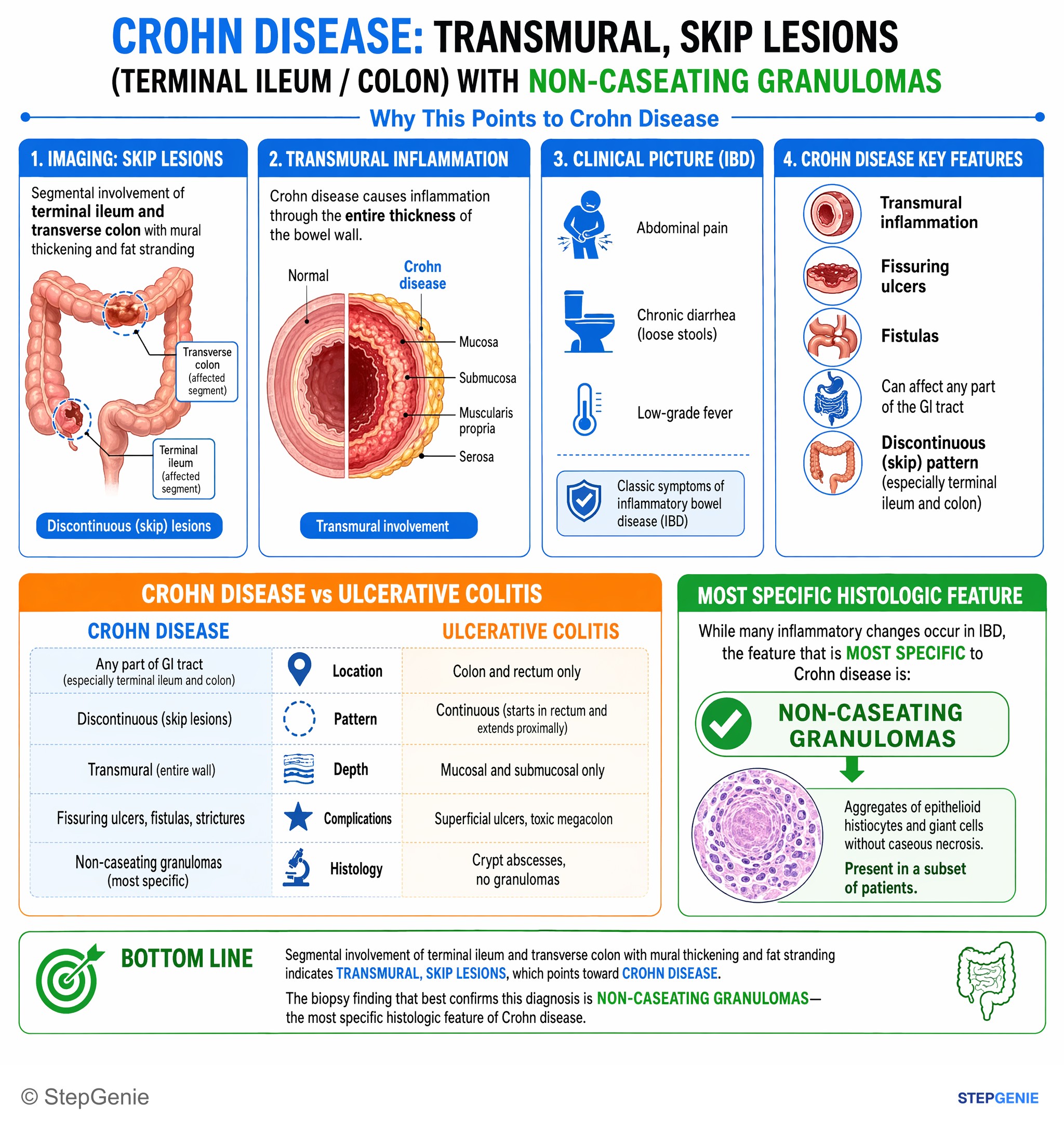 Intestinal and colorectal disorders — StepGenie USMLE Step 1 explanation infographic