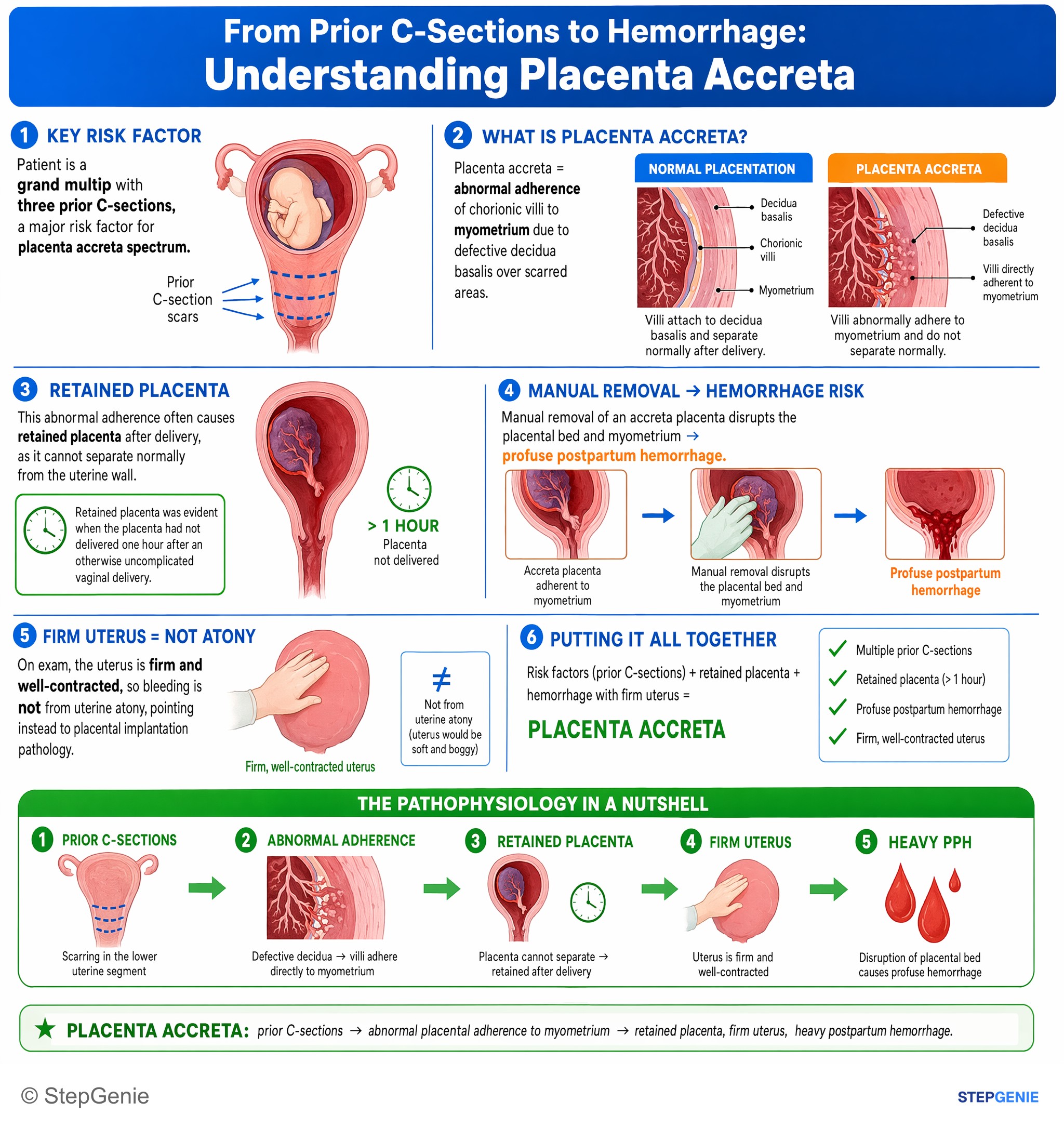 Disorders of pregnancy, childbirth, and puerperium — StepGenie USMLE Step 2 explanation infographic
