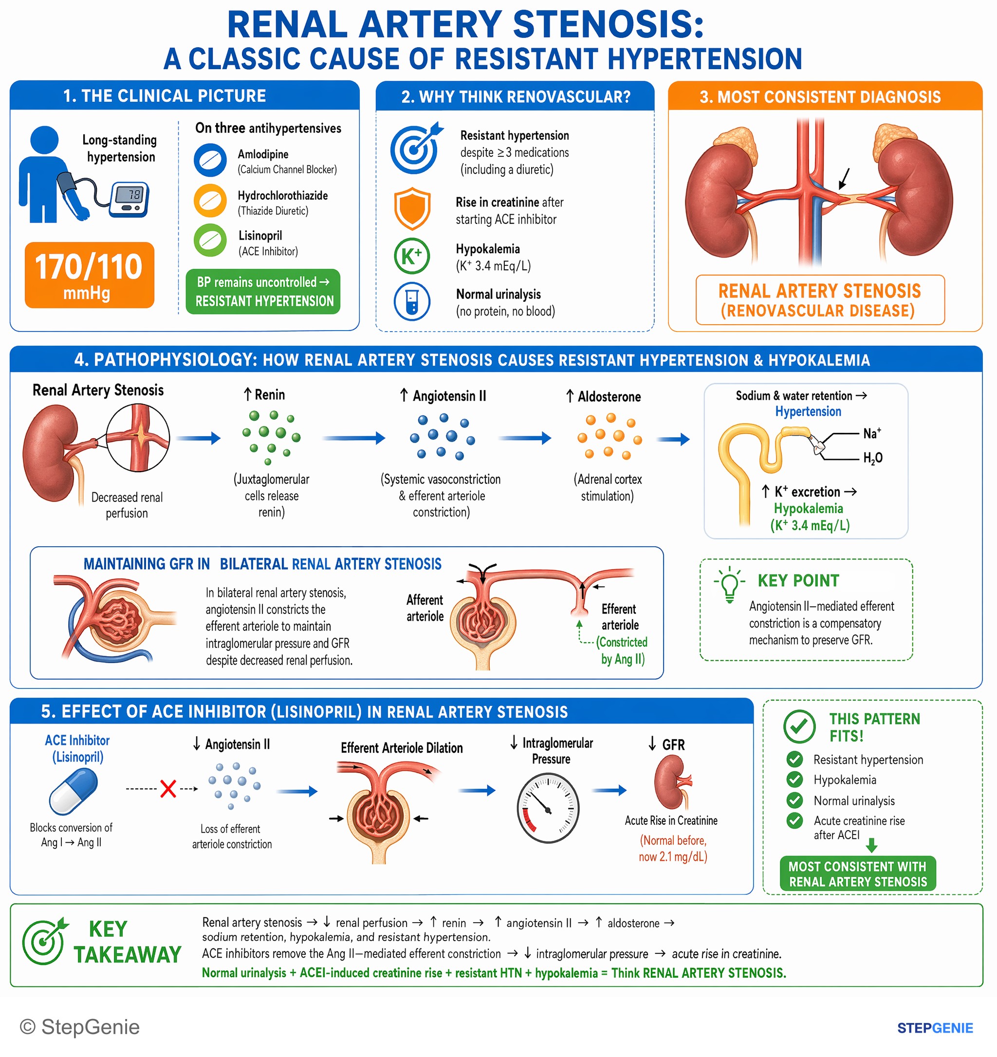 Acute kidney injury — StepGenie USMLE Step 2 explanation infographic