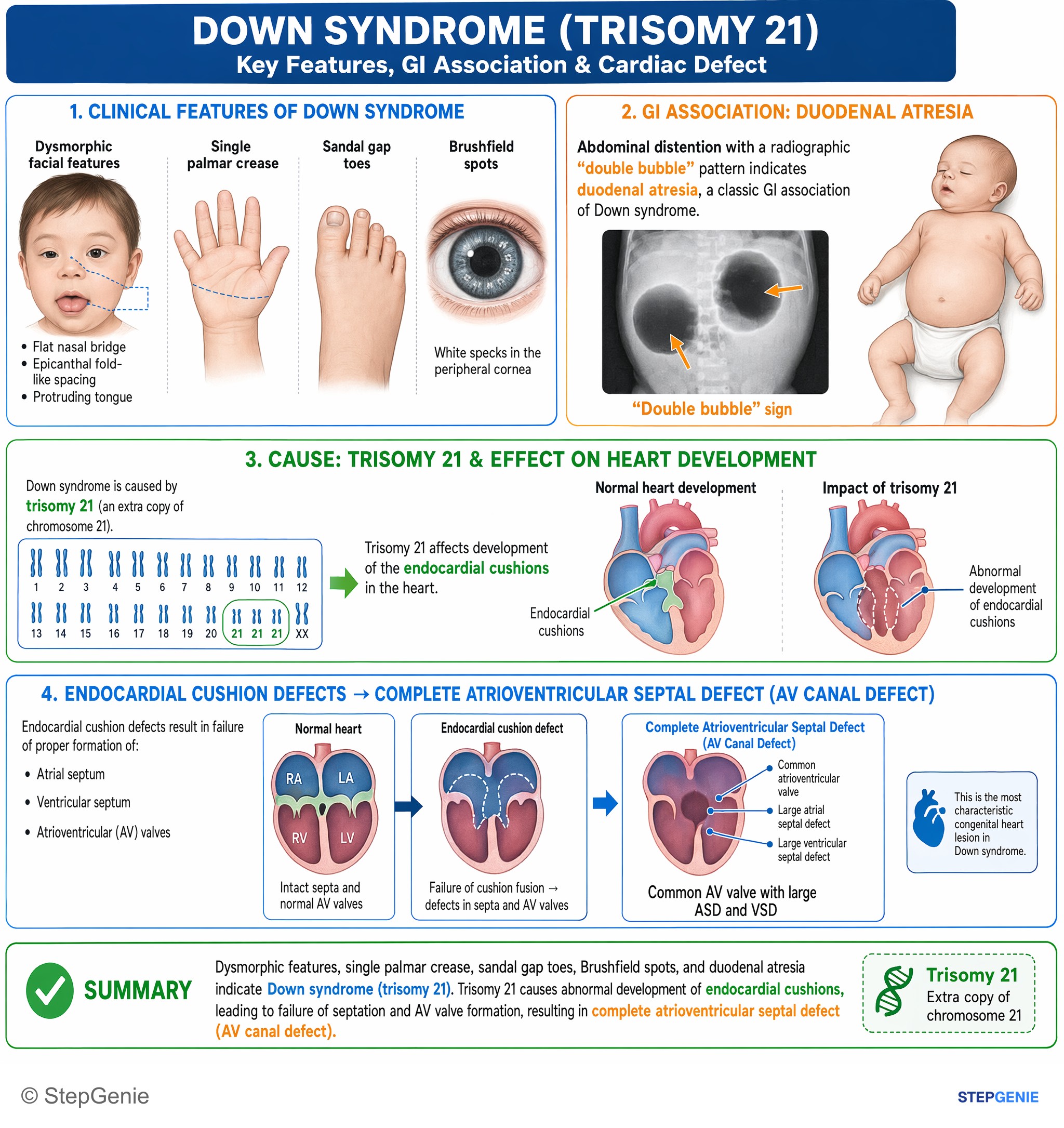 Congenital heart disease — StepGenie USMLE Step 1 explanation infographic