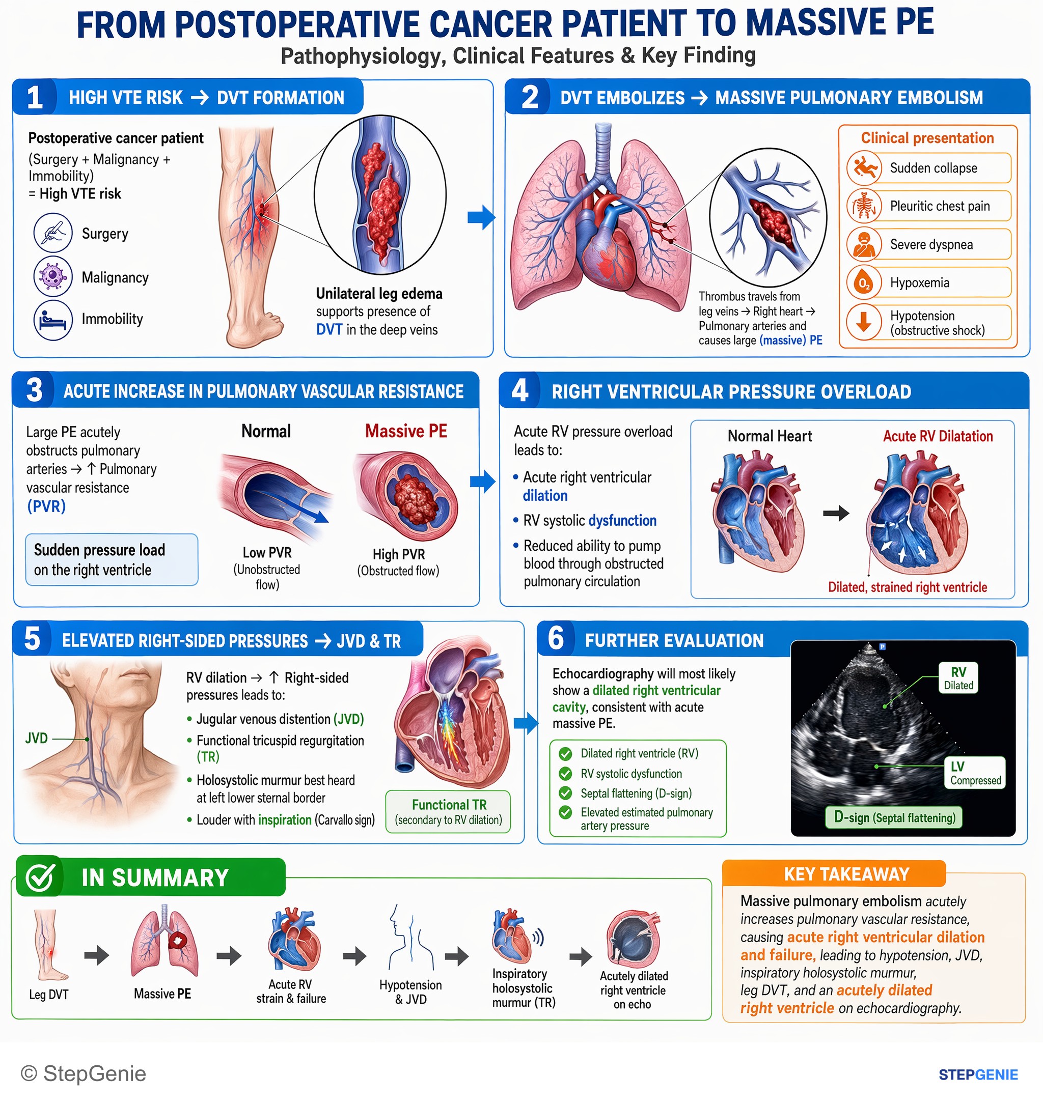 Pulmonary vascular and cardiopulmonary disease — StepGenie USMLE Step 2 explanation infographic