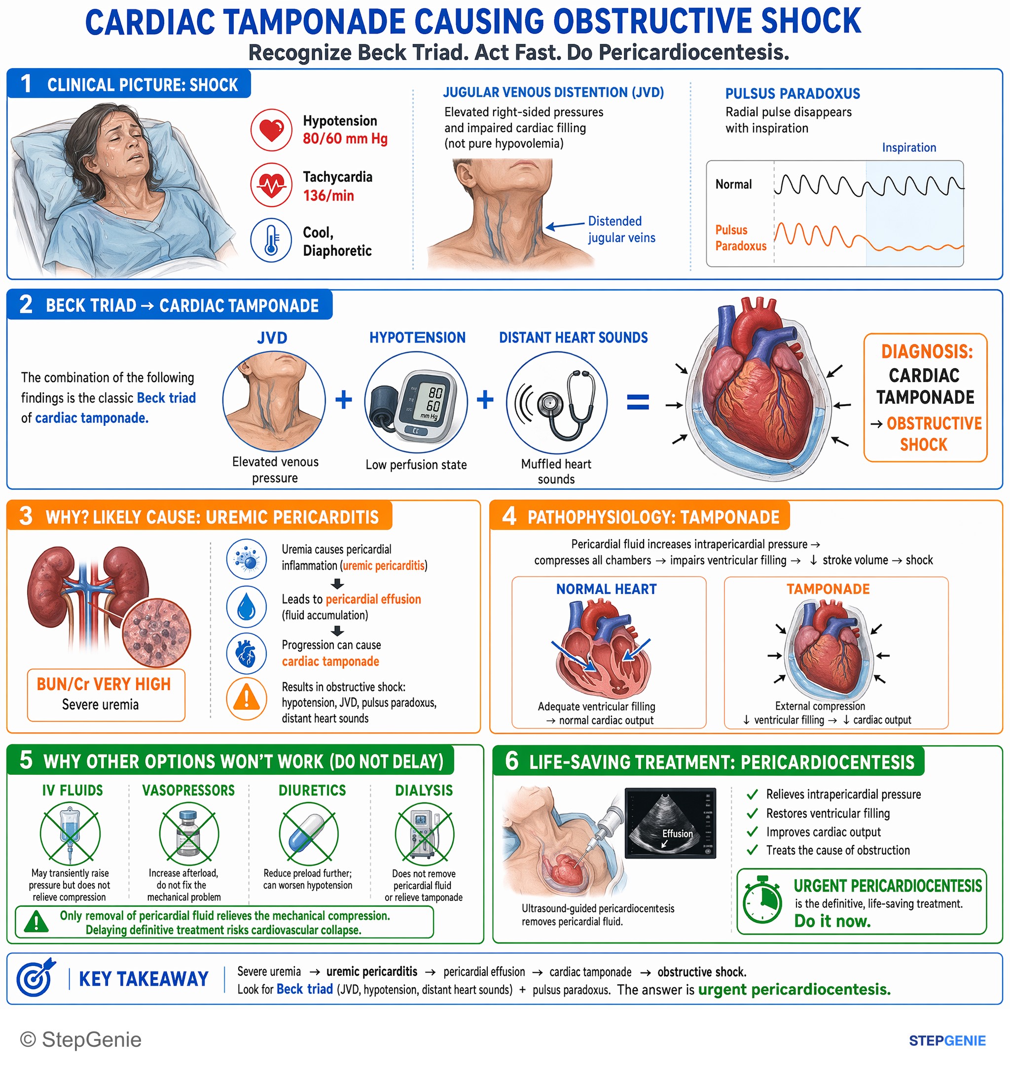 Heart failure and shock — StepGenie USMLE Step 2 explanation infographic
