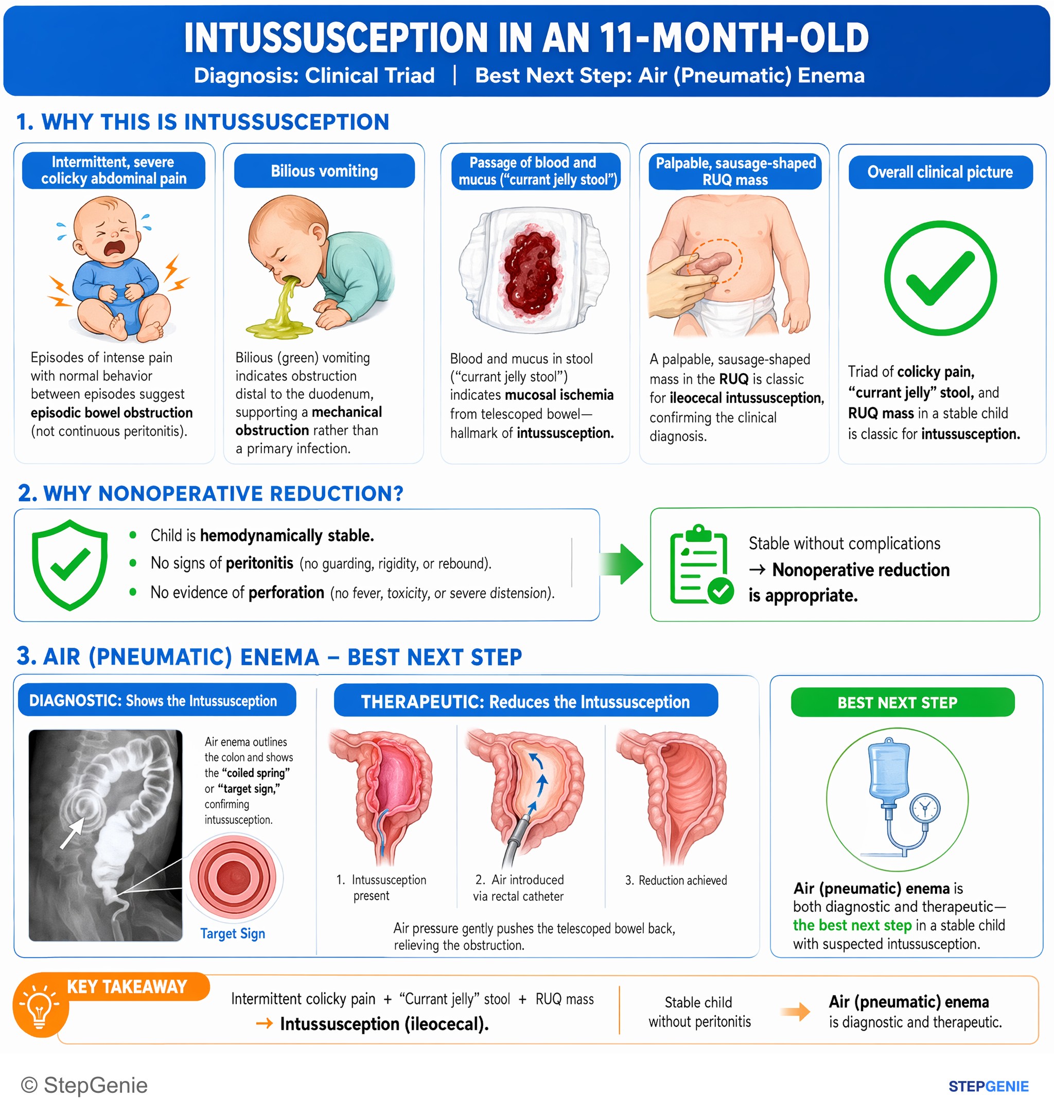Intestinal and colorectal disorders — StepGenie USMLE Step 2 explanation infographic