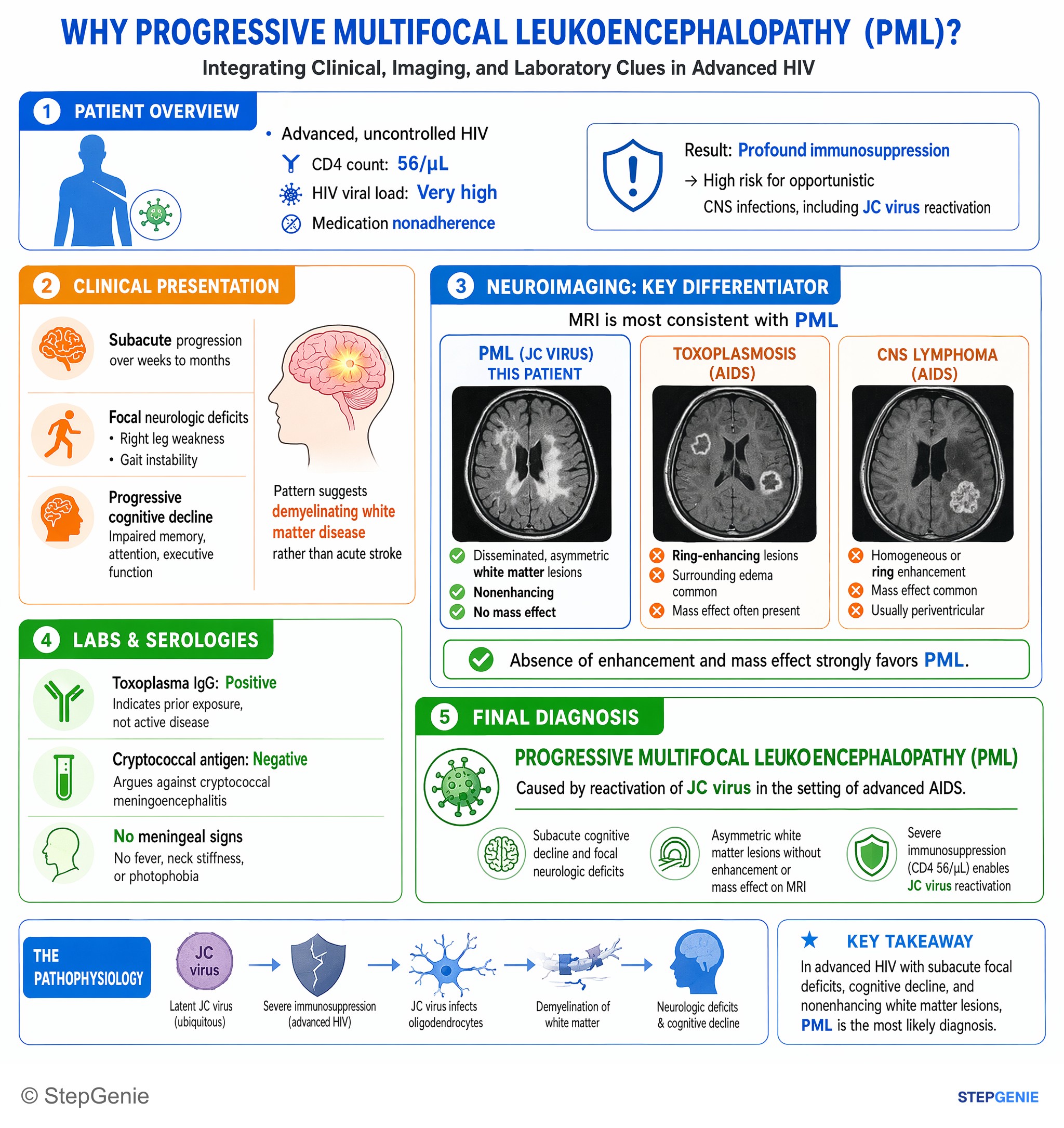 CNS infections — StepGenie USMLE Step 2 explanation infographic