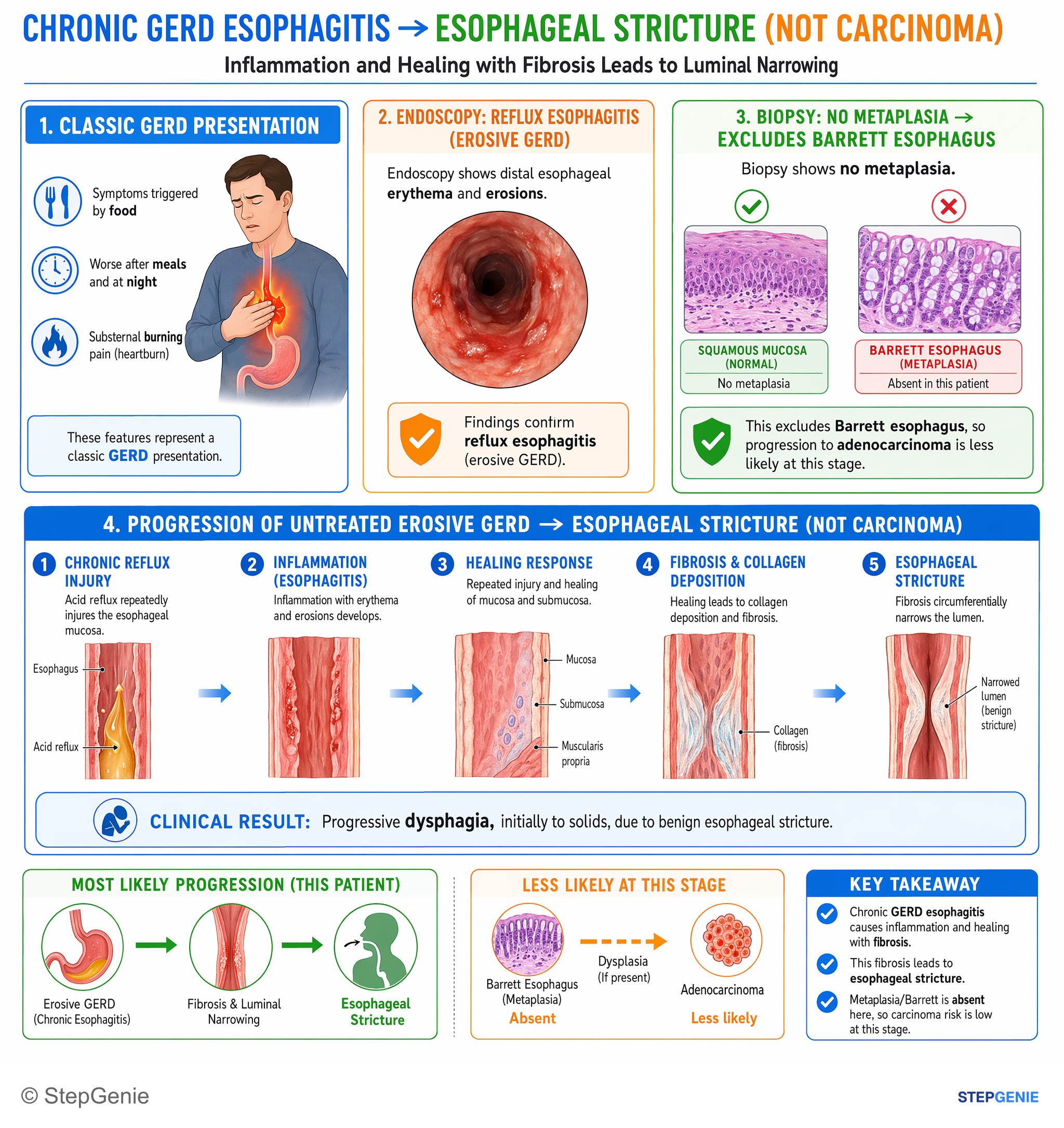 Gastroesophageal disorders — StepGenie USMLE Step 1 explanation infographic