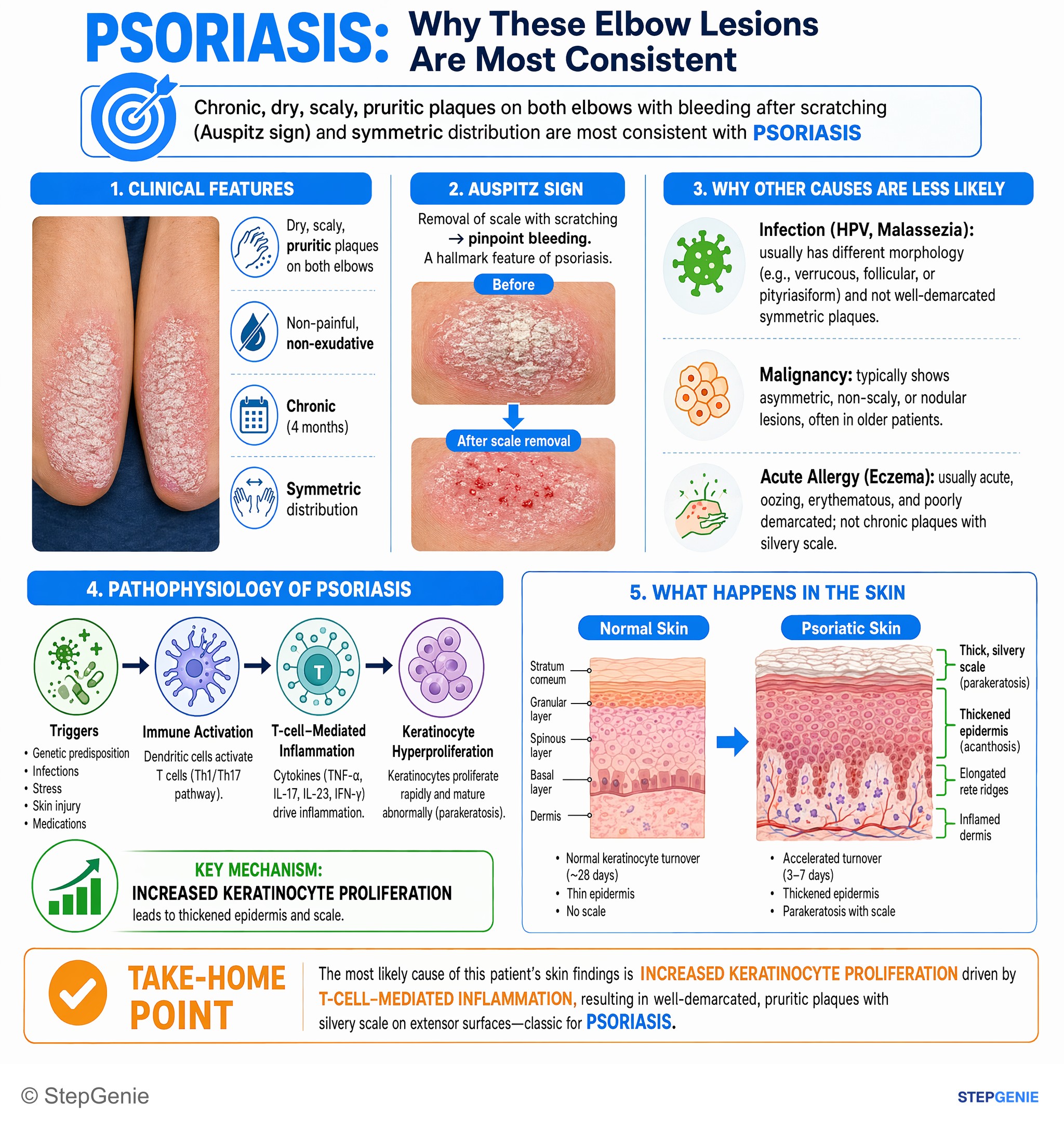 Inflammatory dermatoses and bullous diseases — StepGenie USMLE Step 1 explanation infographic