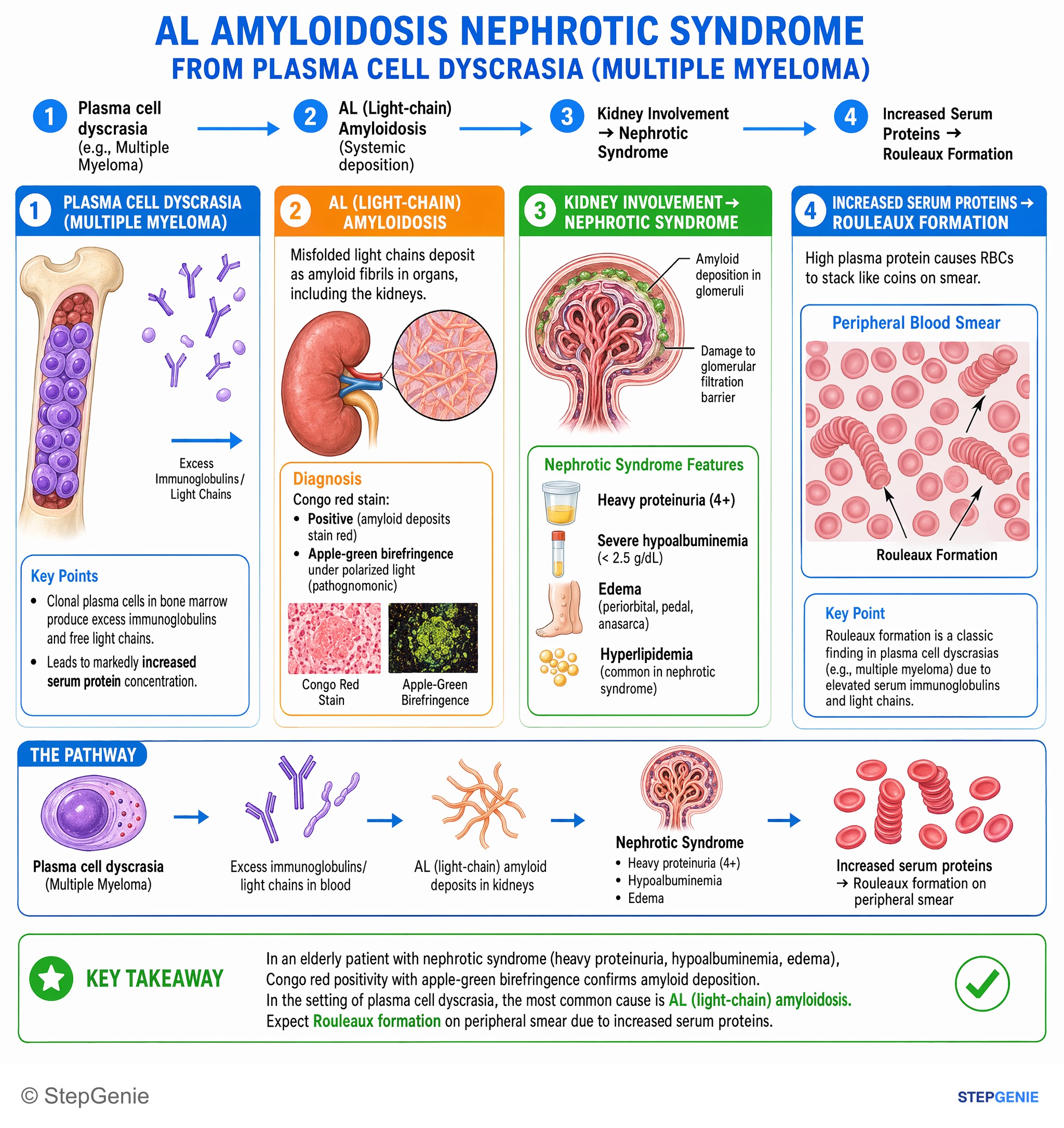 Nephrotic & nephritic syndromes — StepGenie USMLE Step 1 explanation infographic
