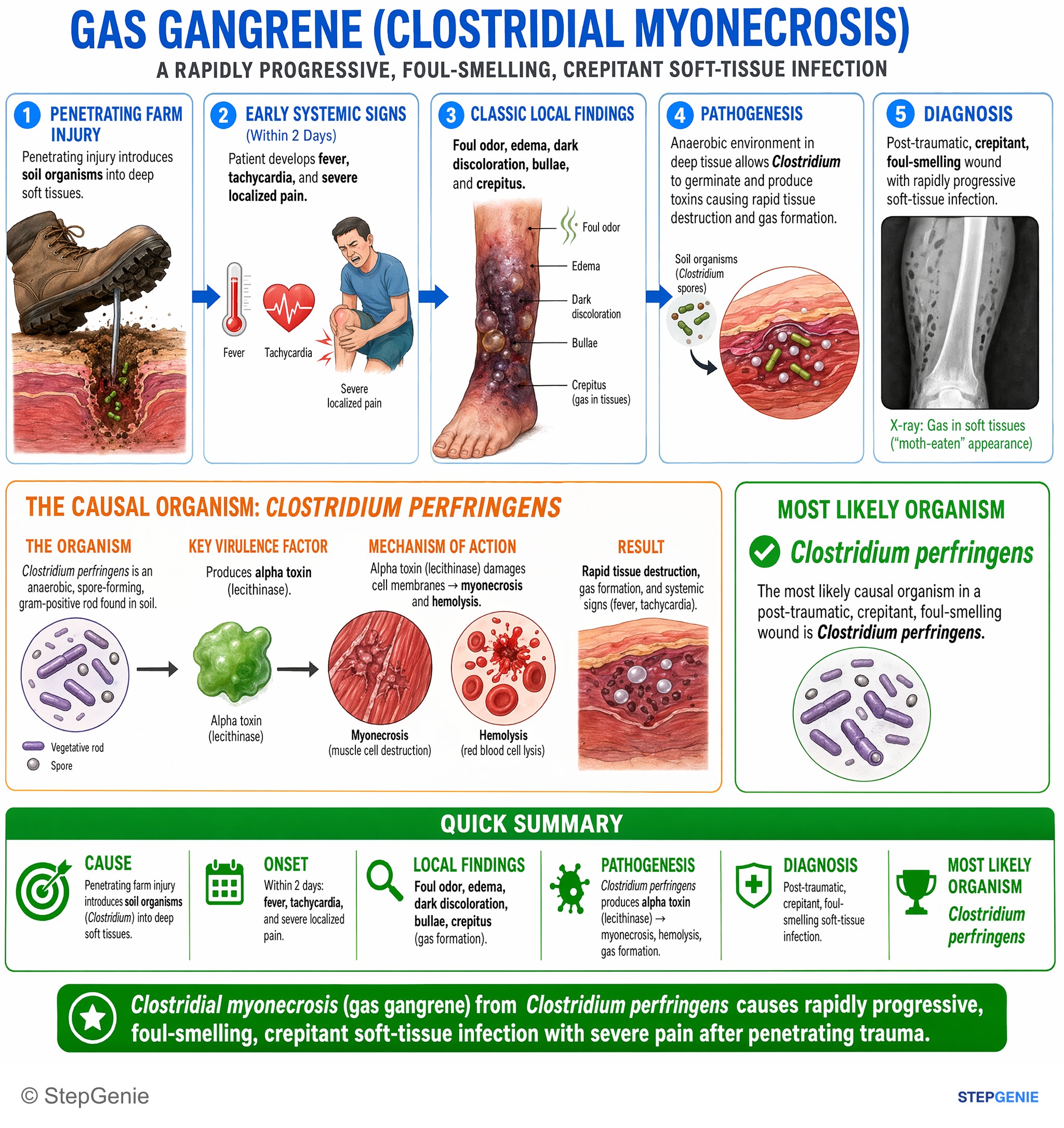 Skin and soft tissue infections — StepGenie USMLE Step 1 explanation infographic