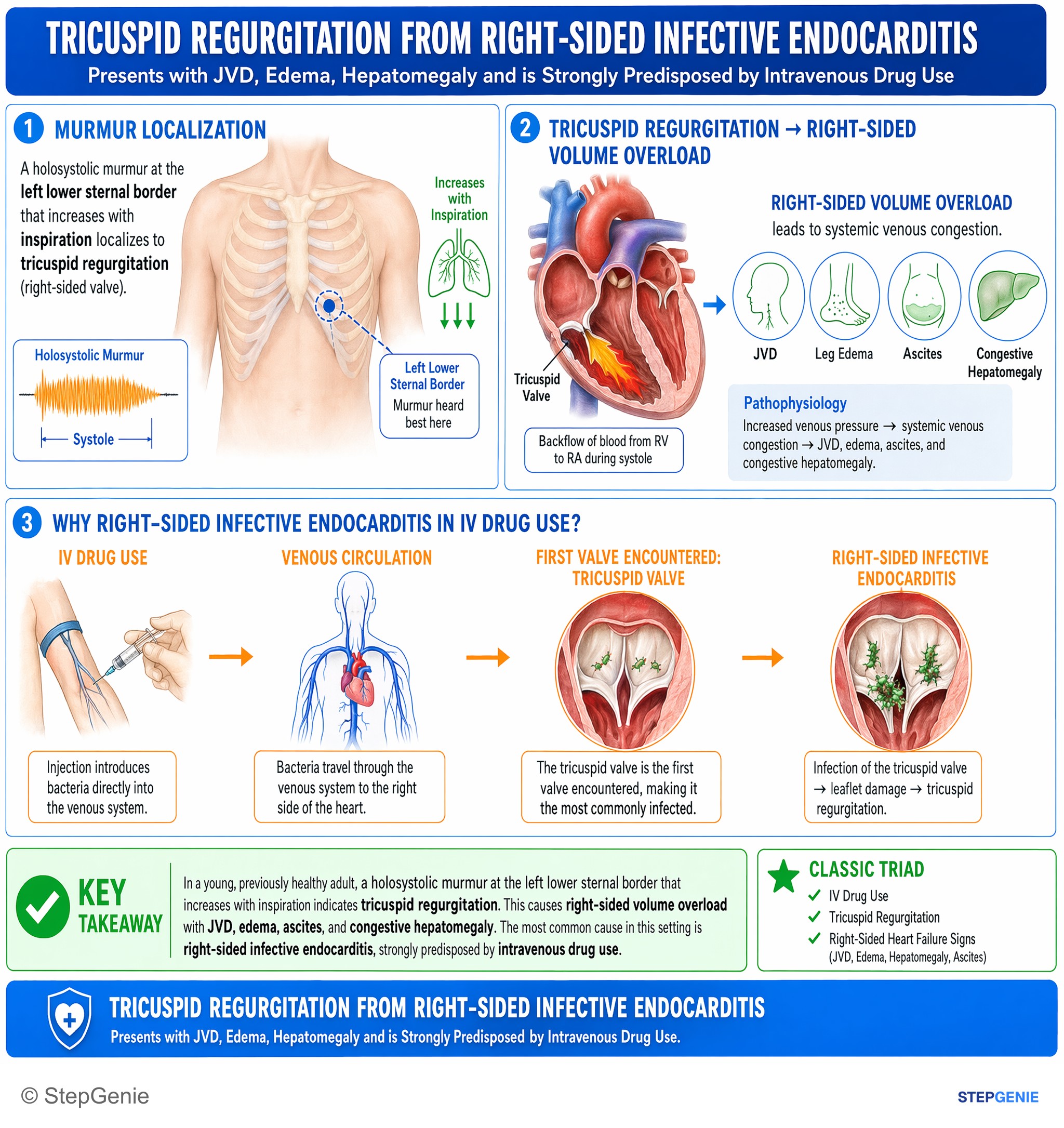 Valvular heart diseases — StepGenie USMLE Step 1 explanation infographic