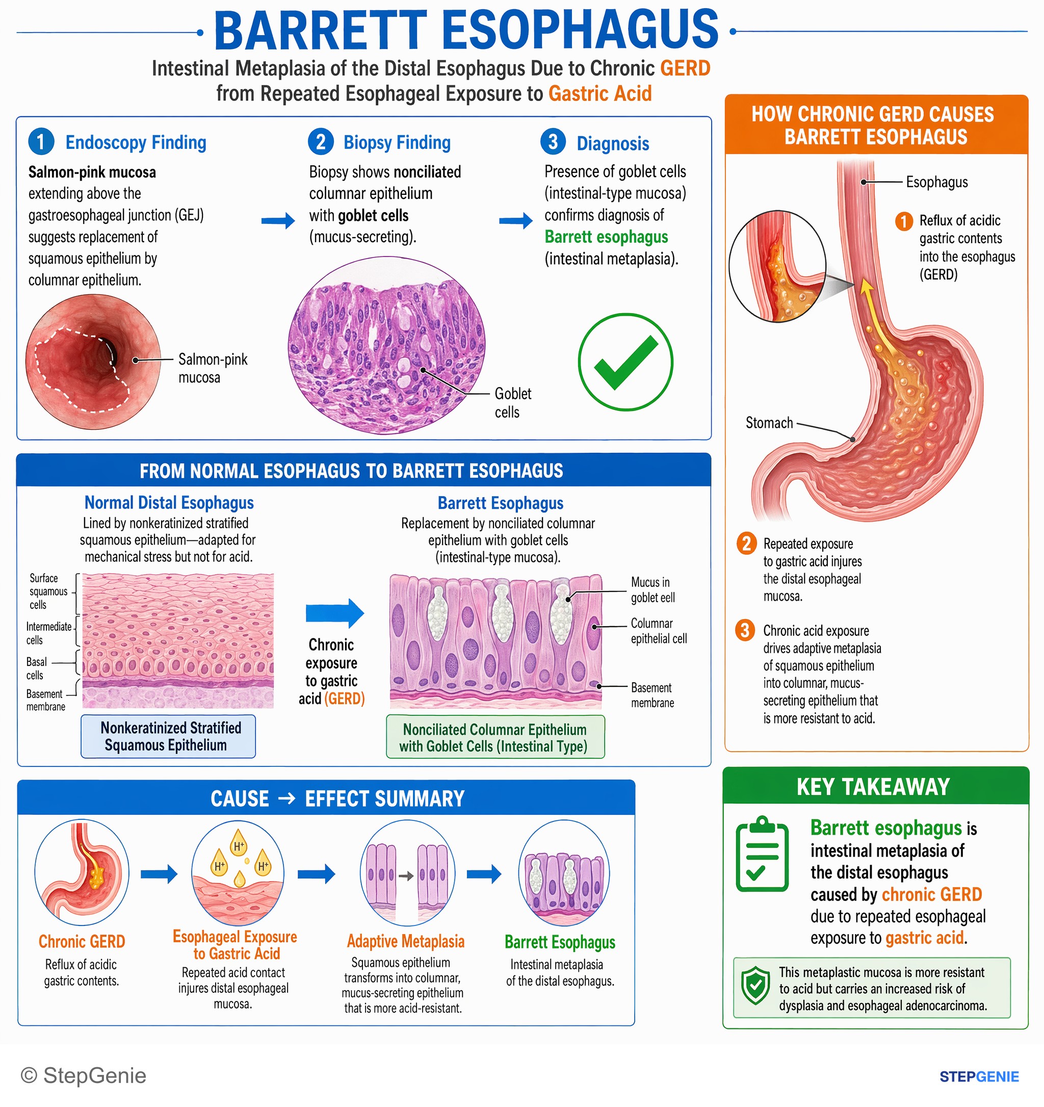 Gastroesophageal disorders — StepGenie USMLE Step 1 explanation infographic