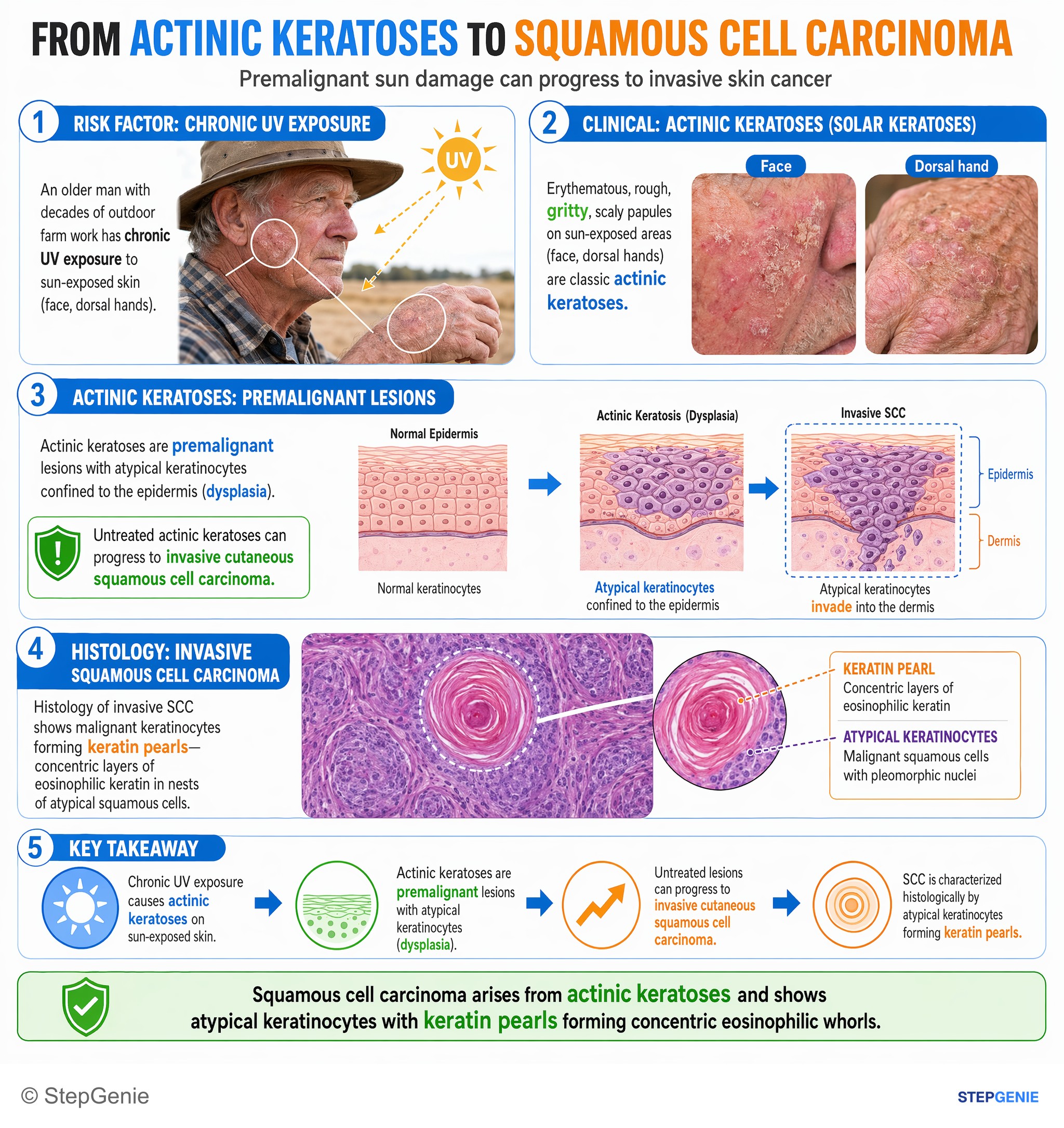 Neoplasia + tumor disorders — StepGenie USMLE Step 1 explanation infographic