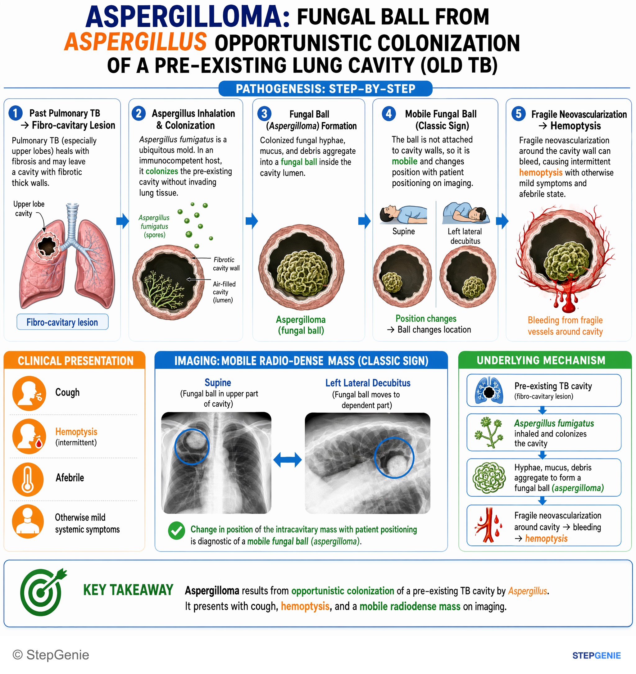 Pulmonary infections — StepGenie USMLE Step 1 explanation infographic